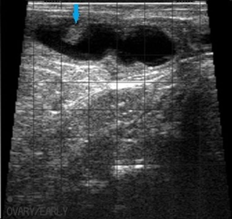 Bovine pregnancy, ultrasonographic image