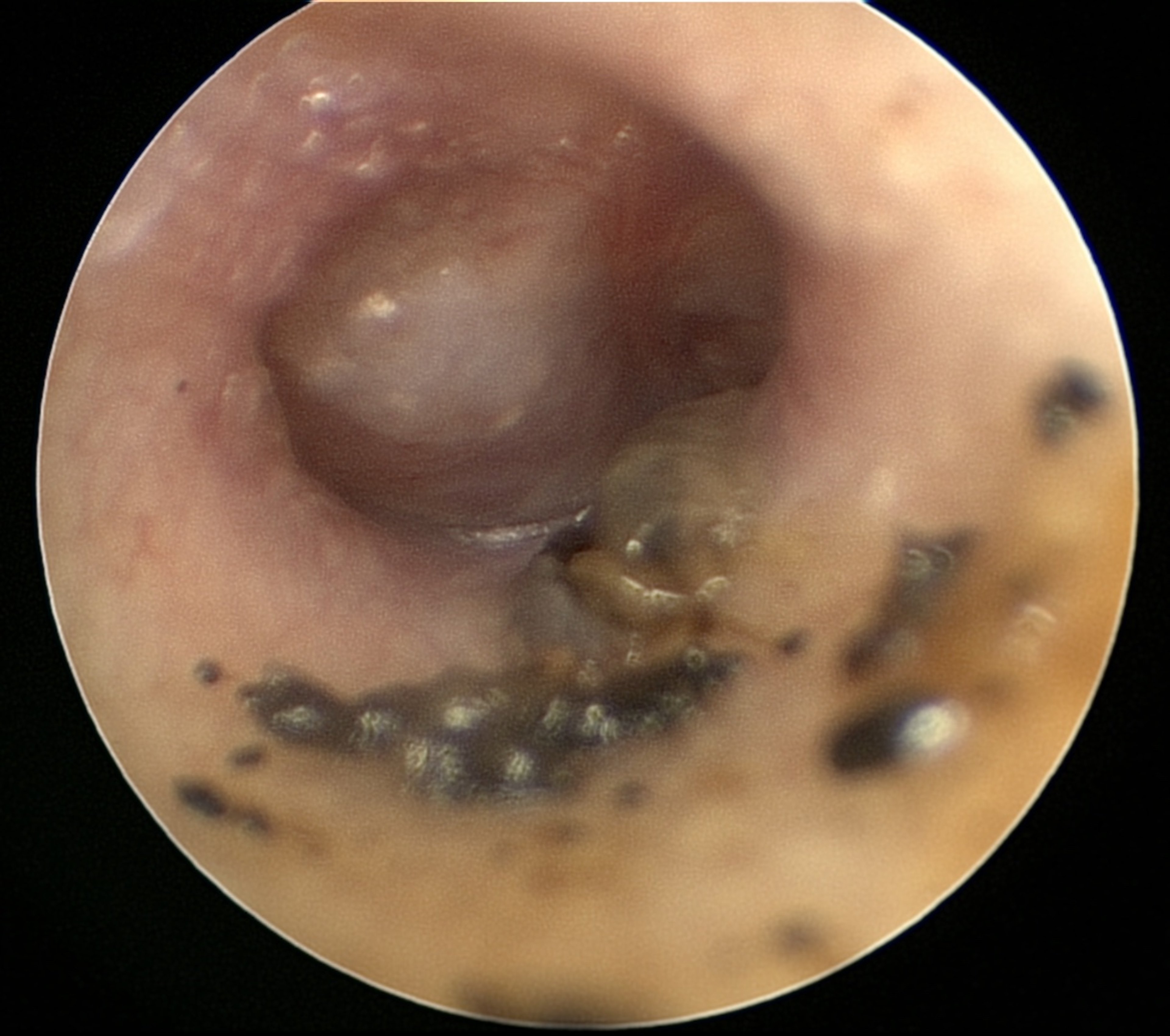 Otitis media, cat