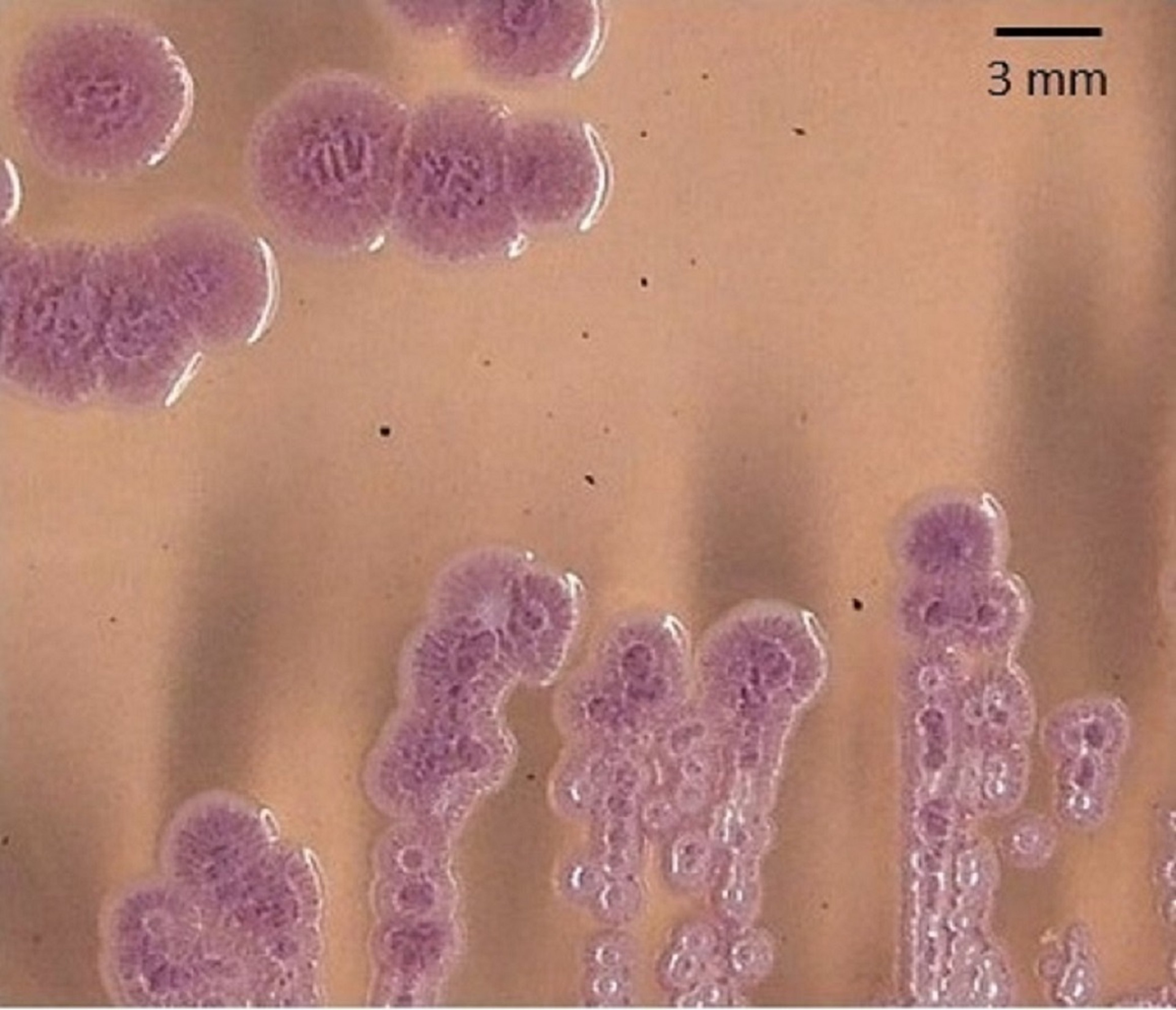 <i >Burkholderia pseudomallei</i>