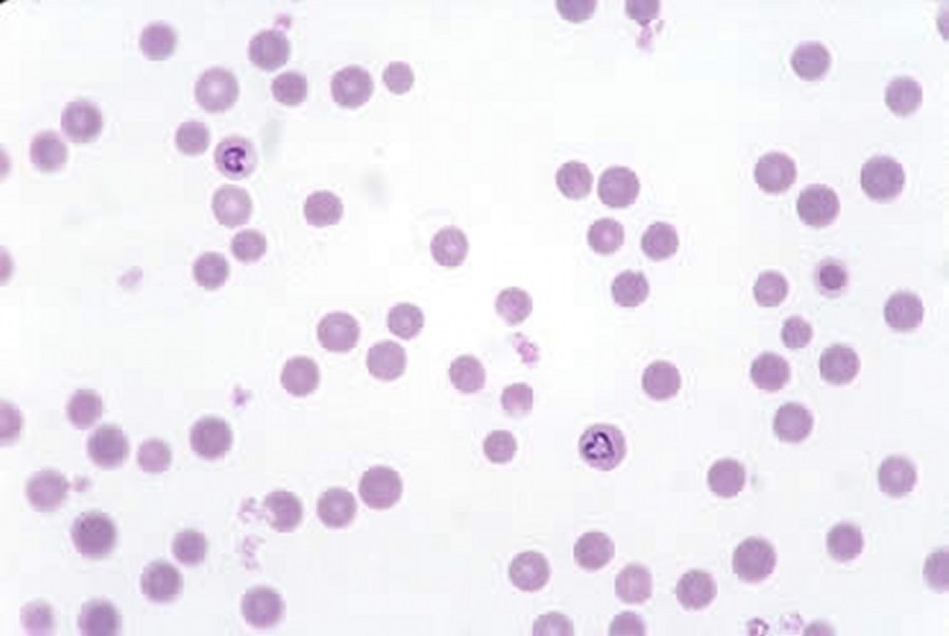 <i >Babesia bigemina</i>, frotis de sangre, vaca