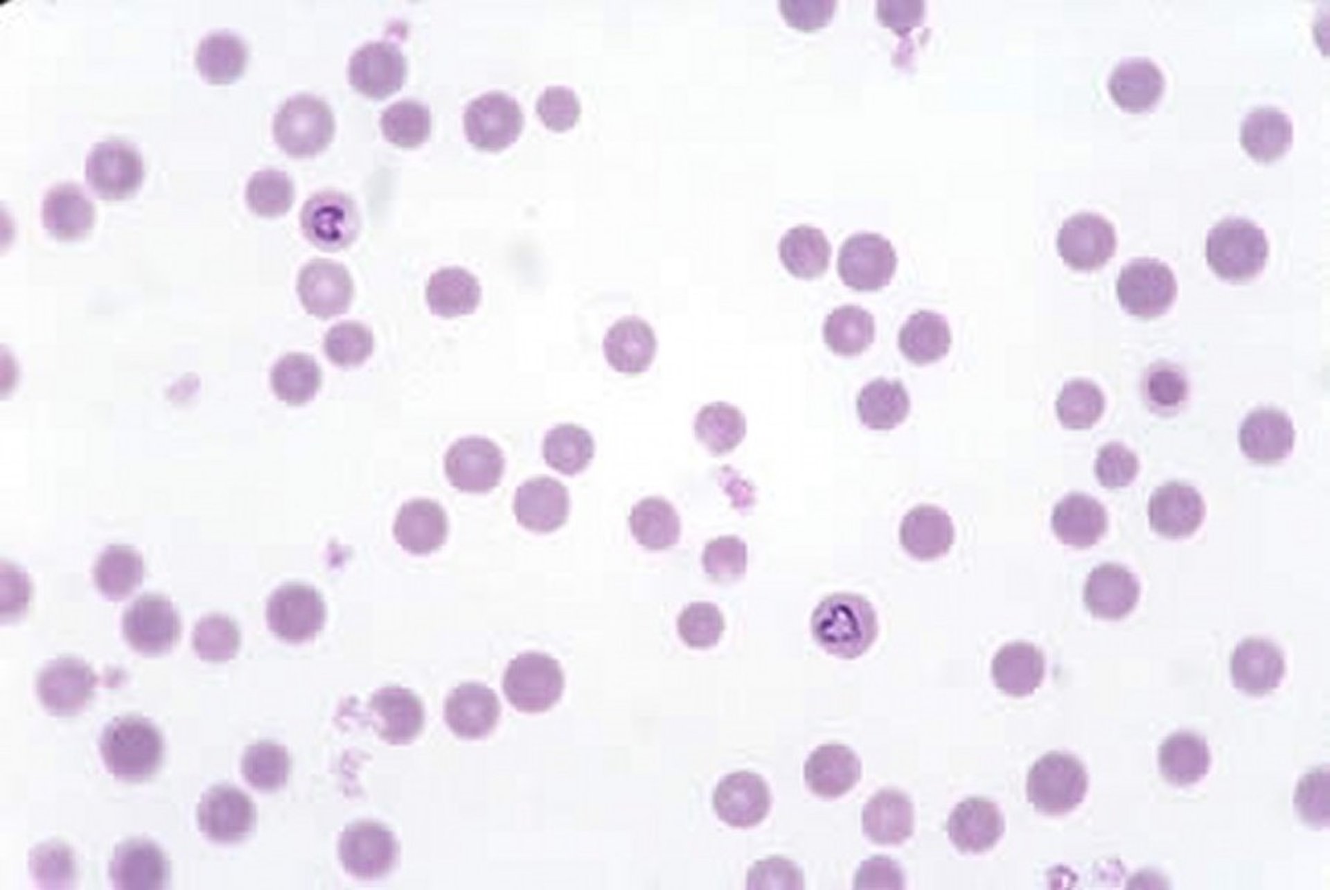 <i >Babesia bigemina</i>, esfregaço de sangue, vaca