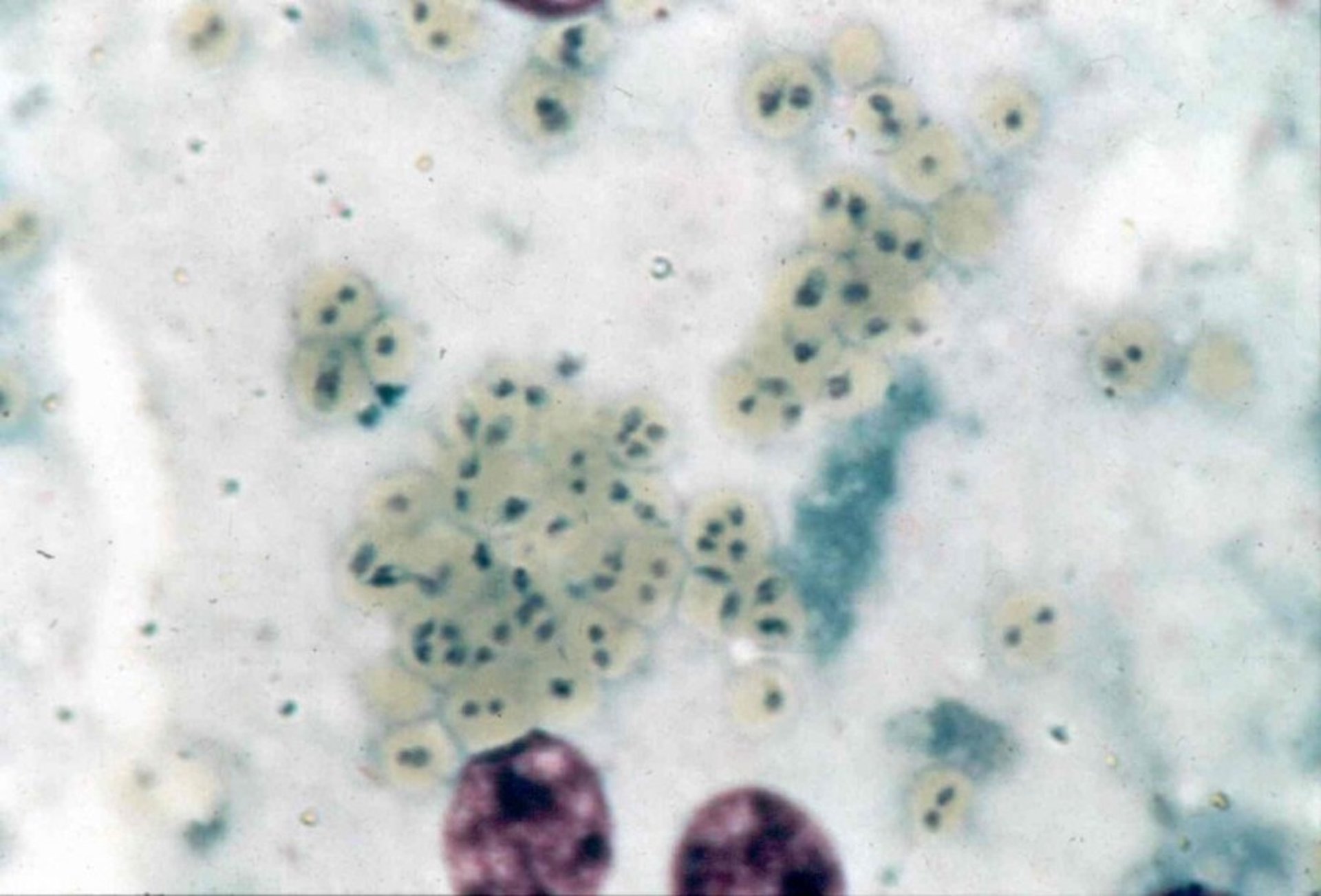 <i >Babesia bovis</i>, frotis de hígado