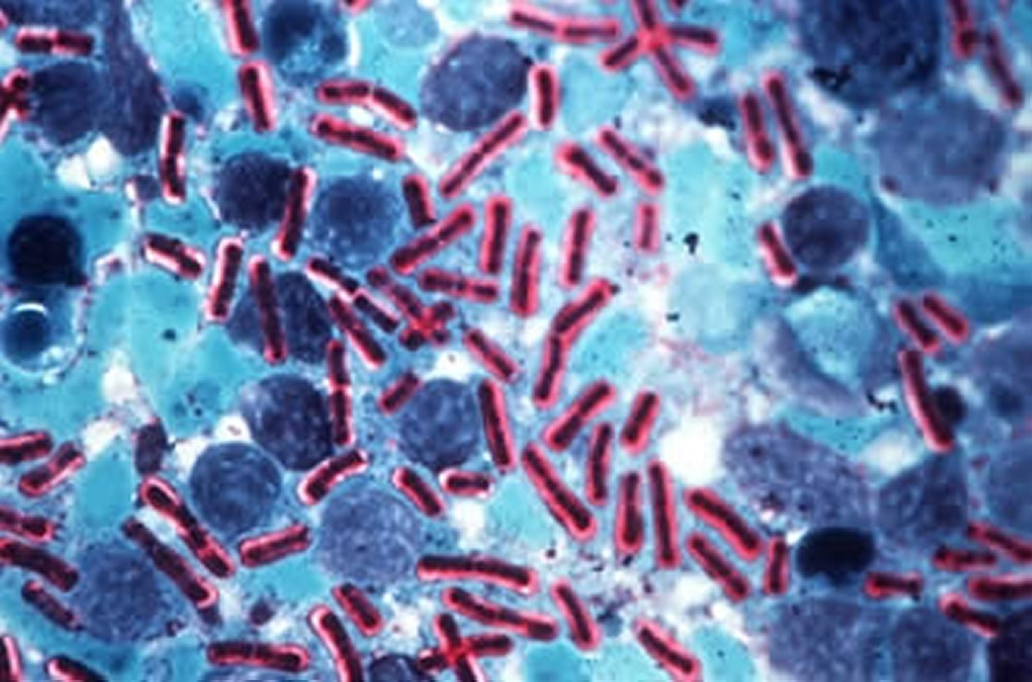 <i >Bacillus anthracis</i>, methylene blue stain