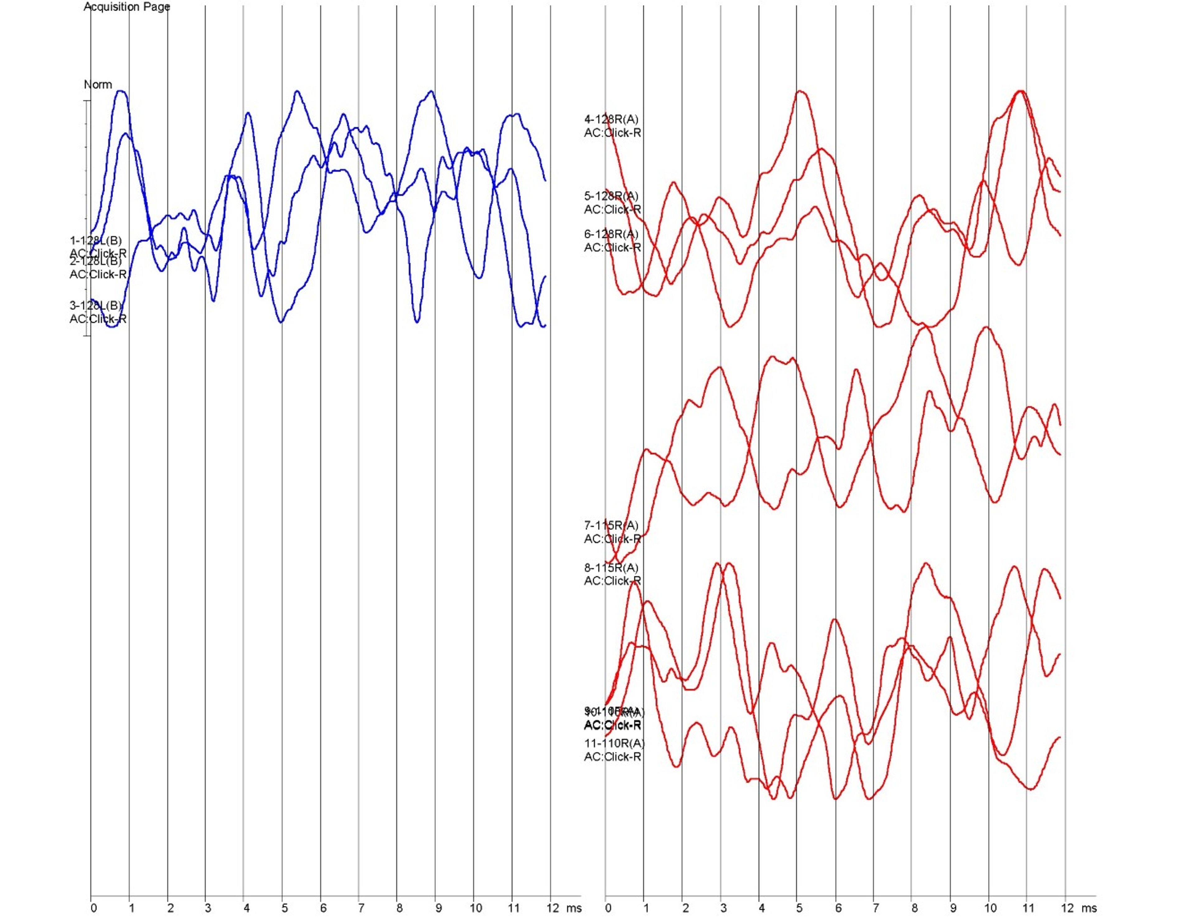 Brainstem auditory evoked response (BAER) testing output, abnormal, dog