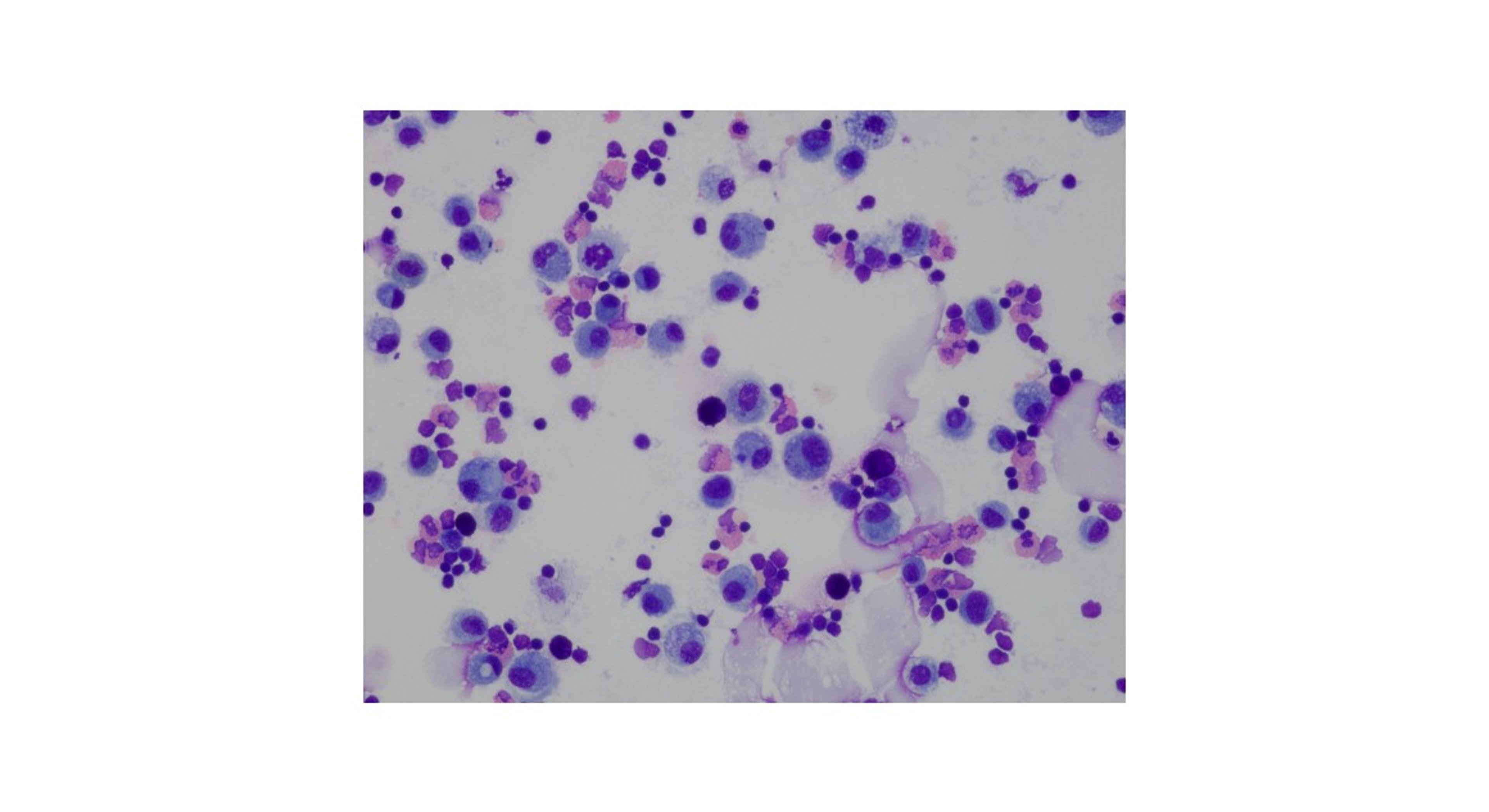 Bronchoalveolar cytospin, eosinophilic inflammation, horse