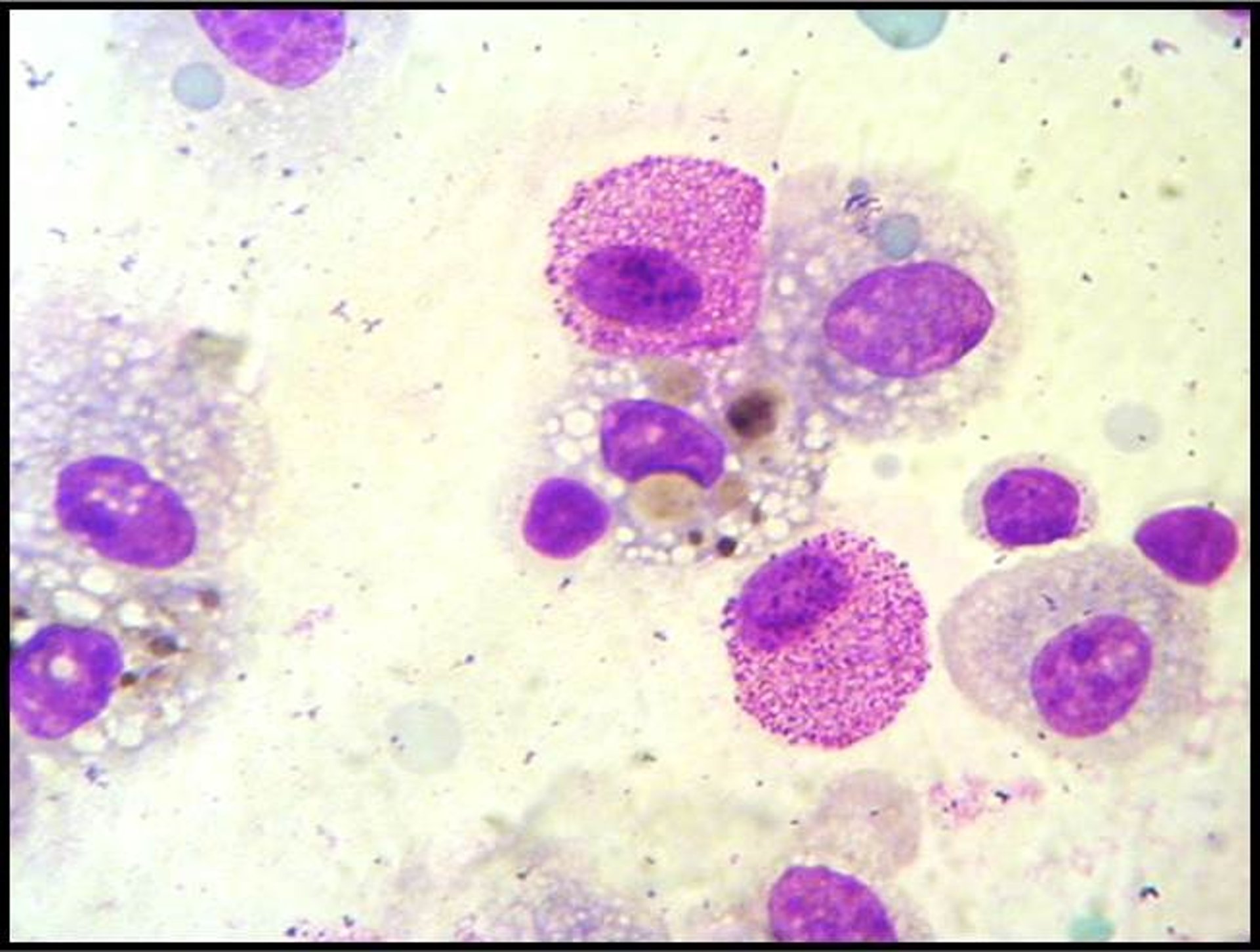Lavado broncoalveolar, hemosiderófagos, caballo