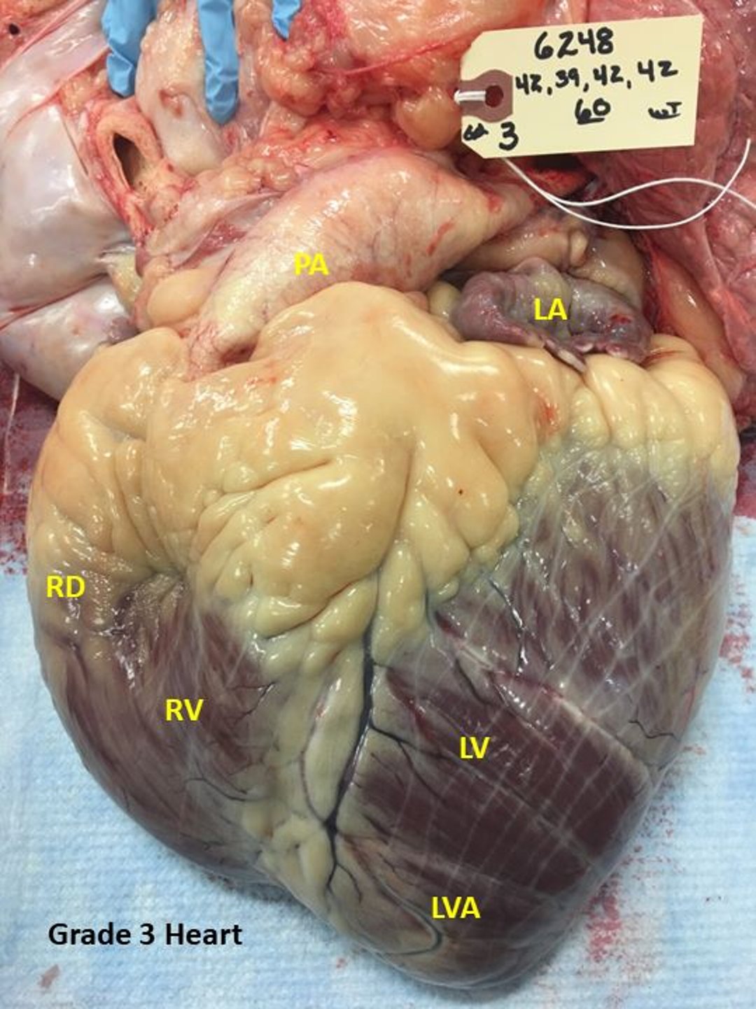 Bovine high-mountain disease, cardiac grade 3, steer