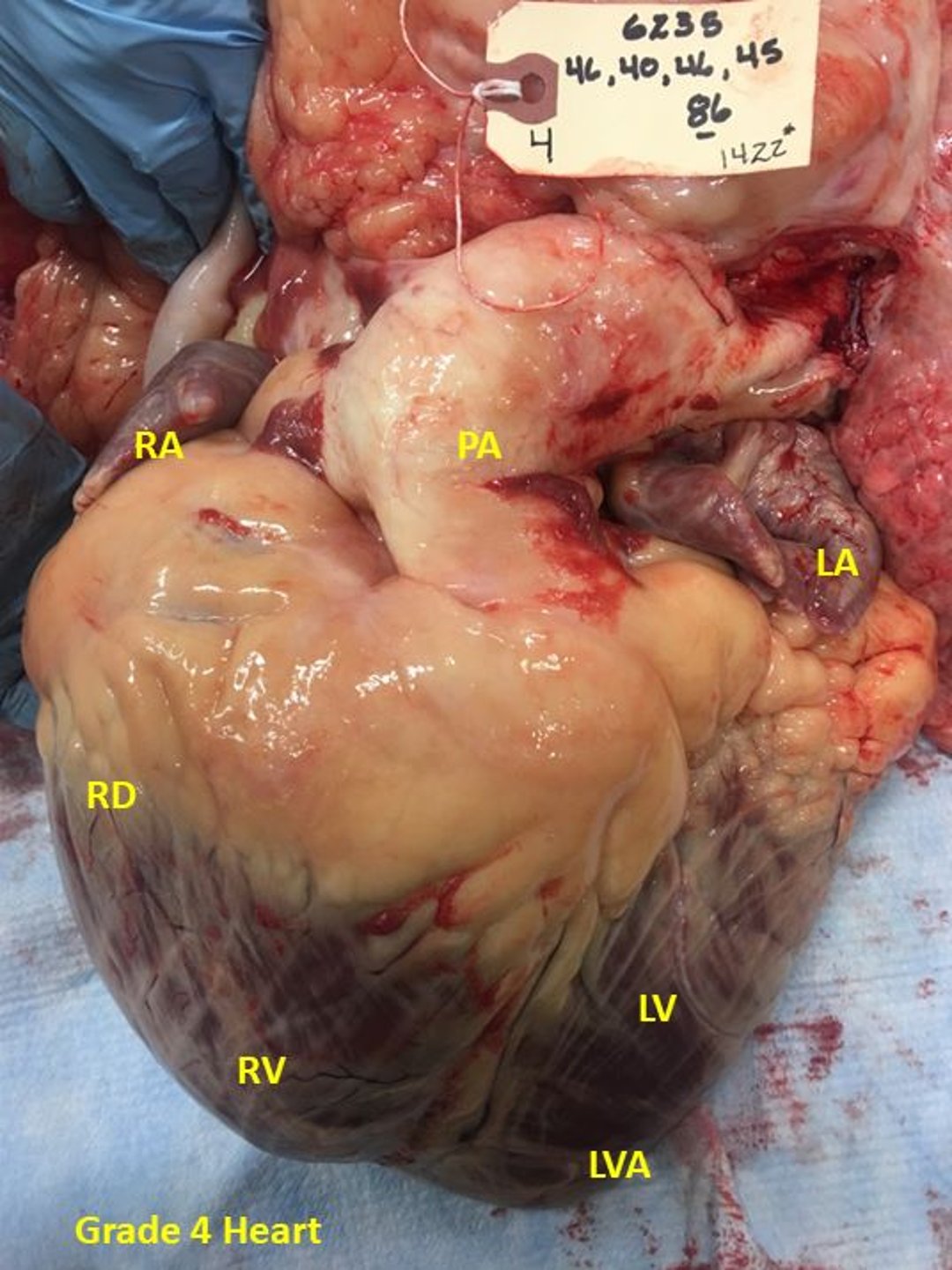 Bovine high-mountain disease, cardiac grade 4, steer