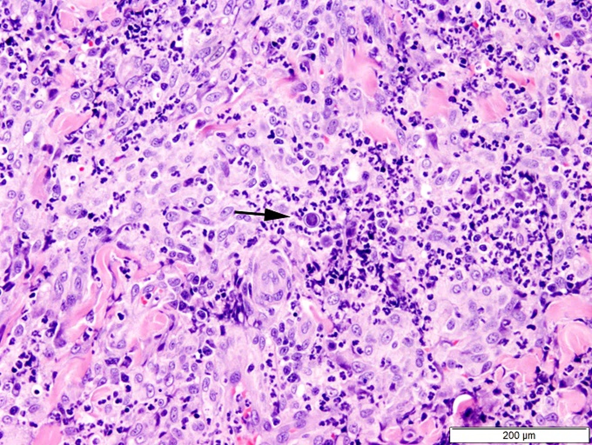 <i >Blastomyces</i>, levadura, perro