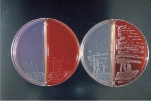 Morfología de la colonia de Bordetella avium y B hinzii