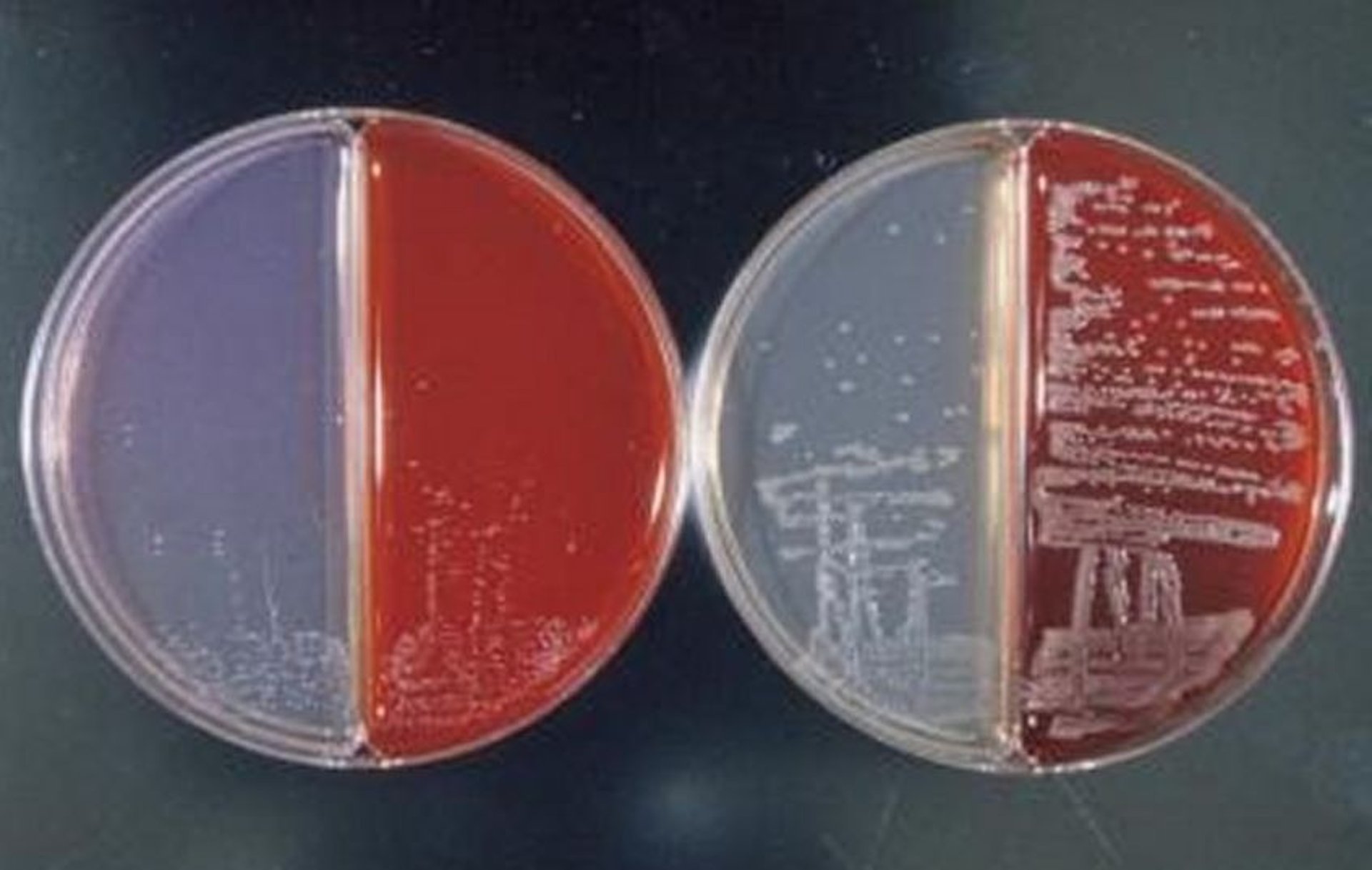 <i >Bordetella avium </i>and <i >Bordetella hinzii</i> colony morphology