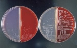Morfología de la colonia de Bordetella avium y B hinzii