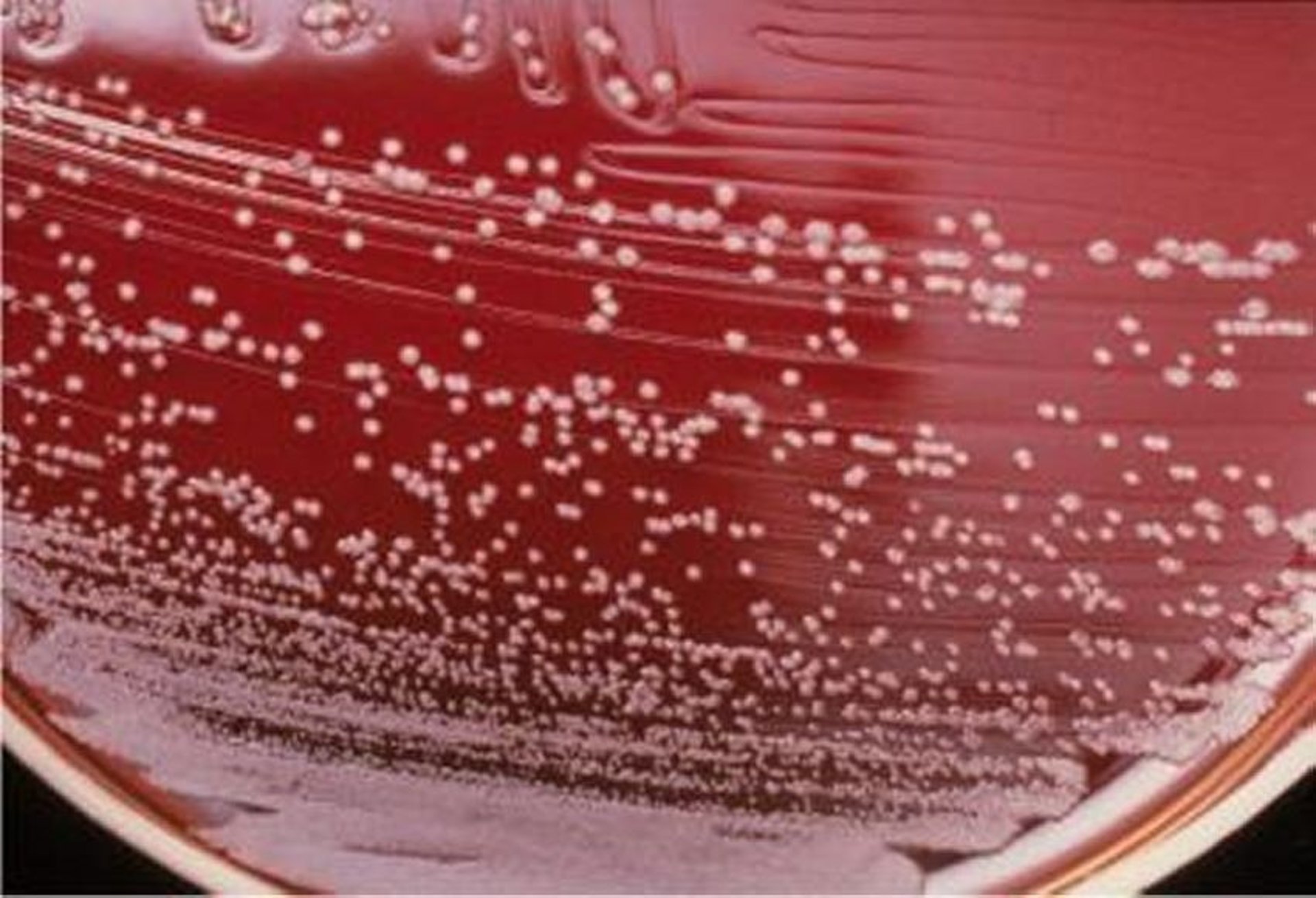 <i >Bordetella avium</i>, rough colony morphology