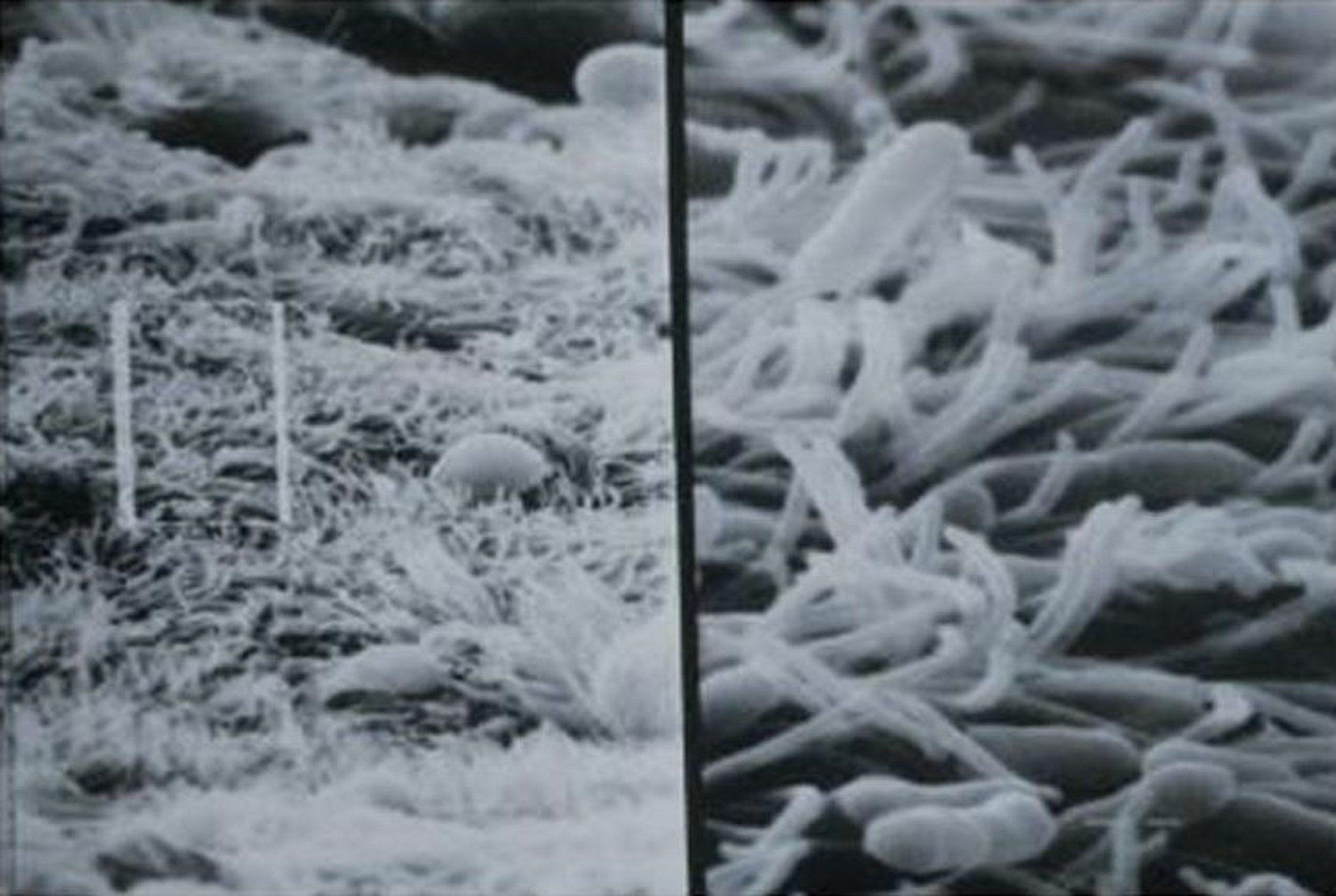<i >Bordetella avium</i>, trachea, poult, 3 days after infection