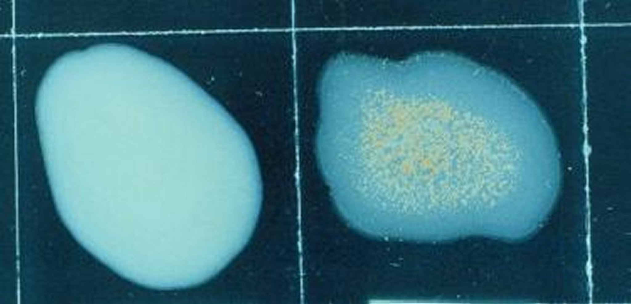 <i >Bordetella</i>, hemaglutinación