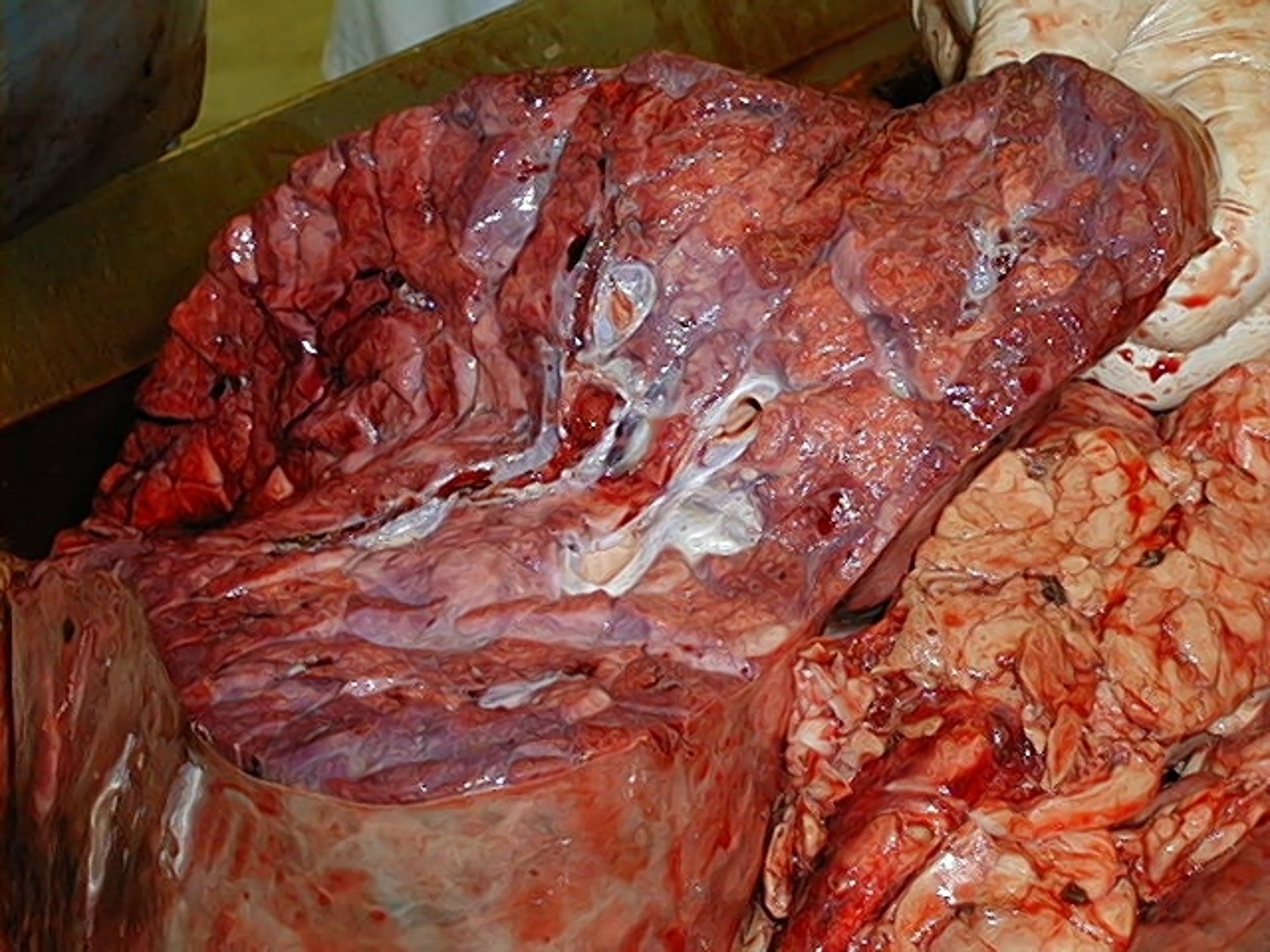 Lesiones anatomopatológicas asociadas al virus respiratorio sincitial bovino