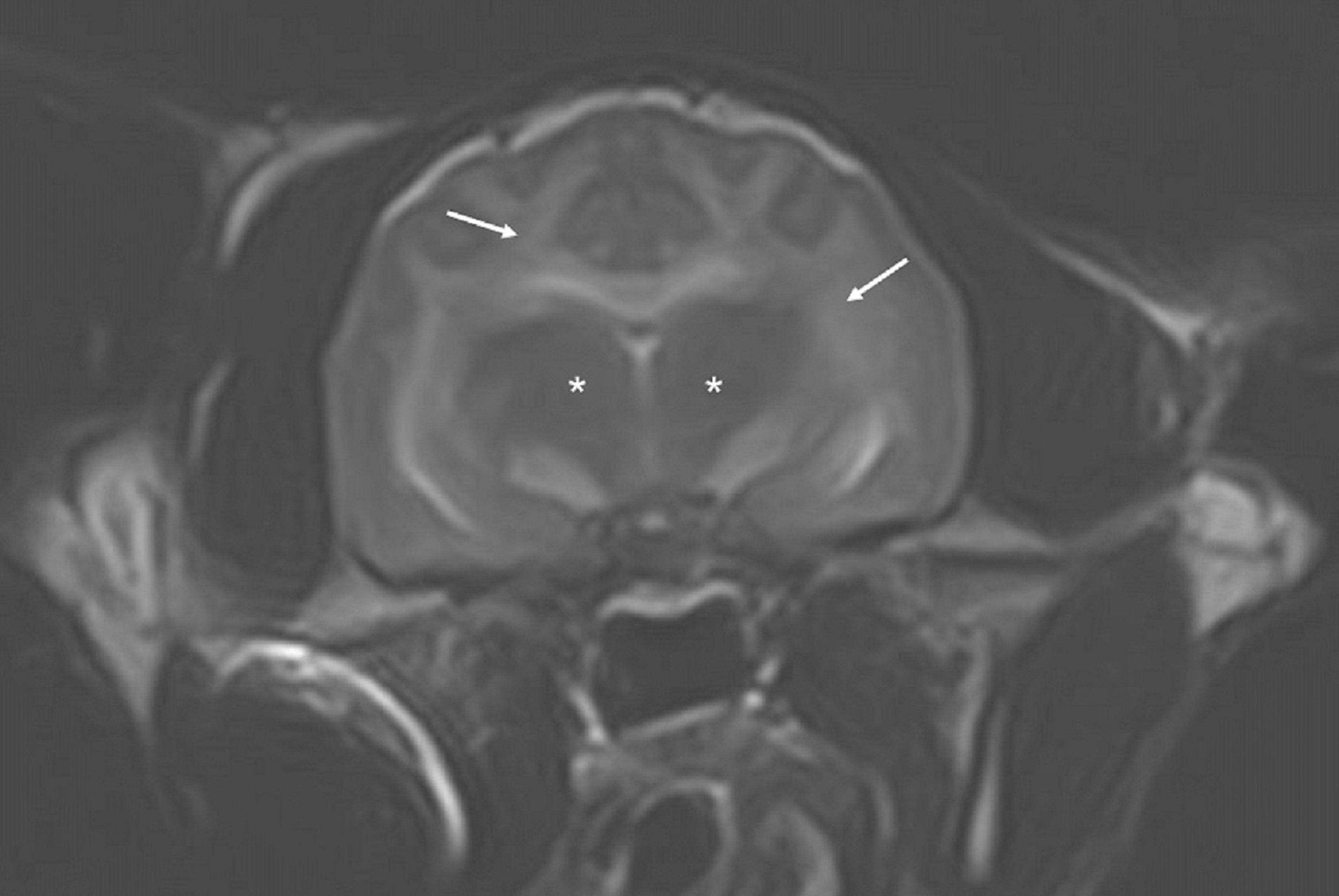 Brain MRI, cat with bromethalin toxicosis
