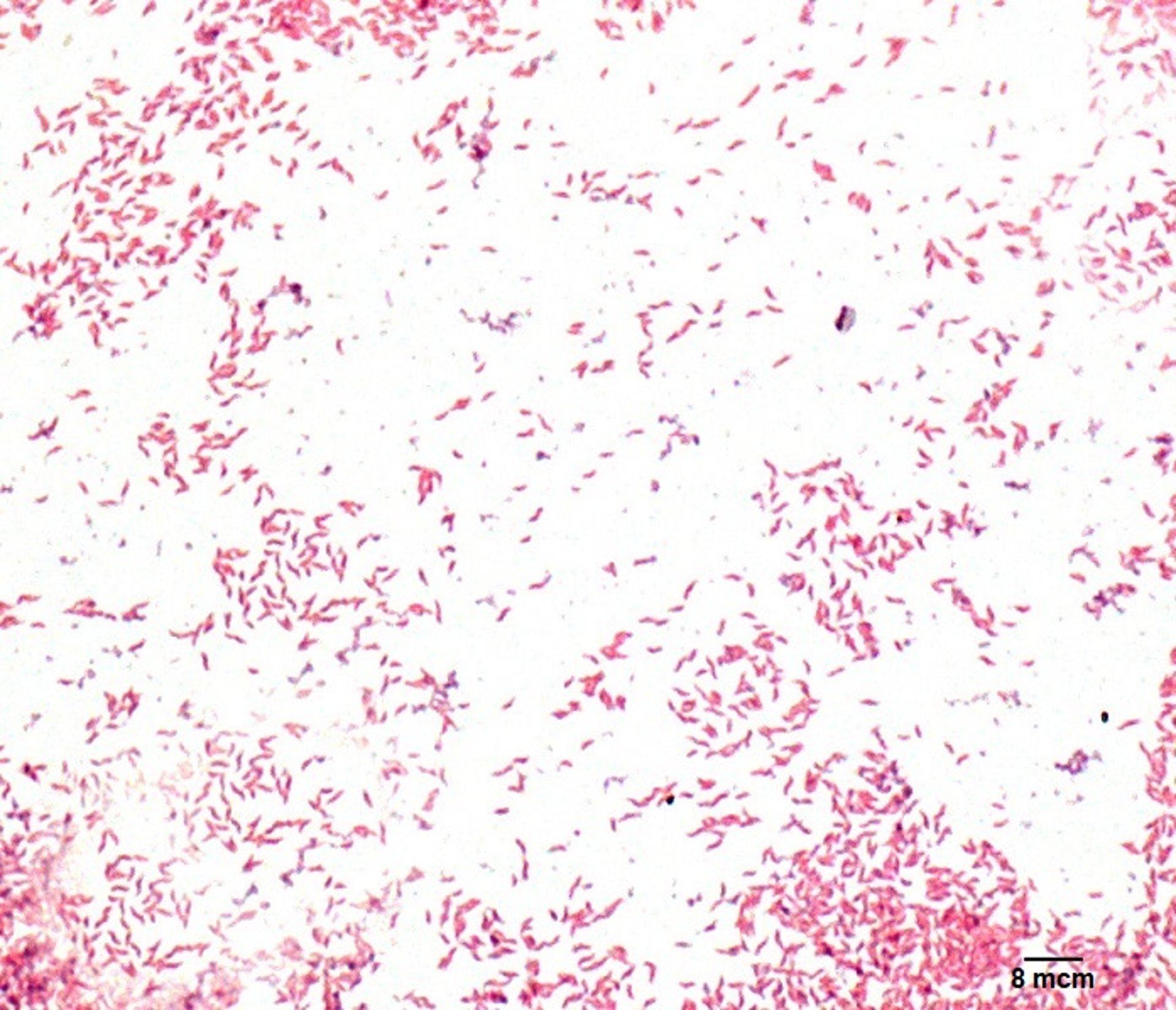 <i >Campylobacter jejuni</i>, Gram-stained smear of intestine, dog