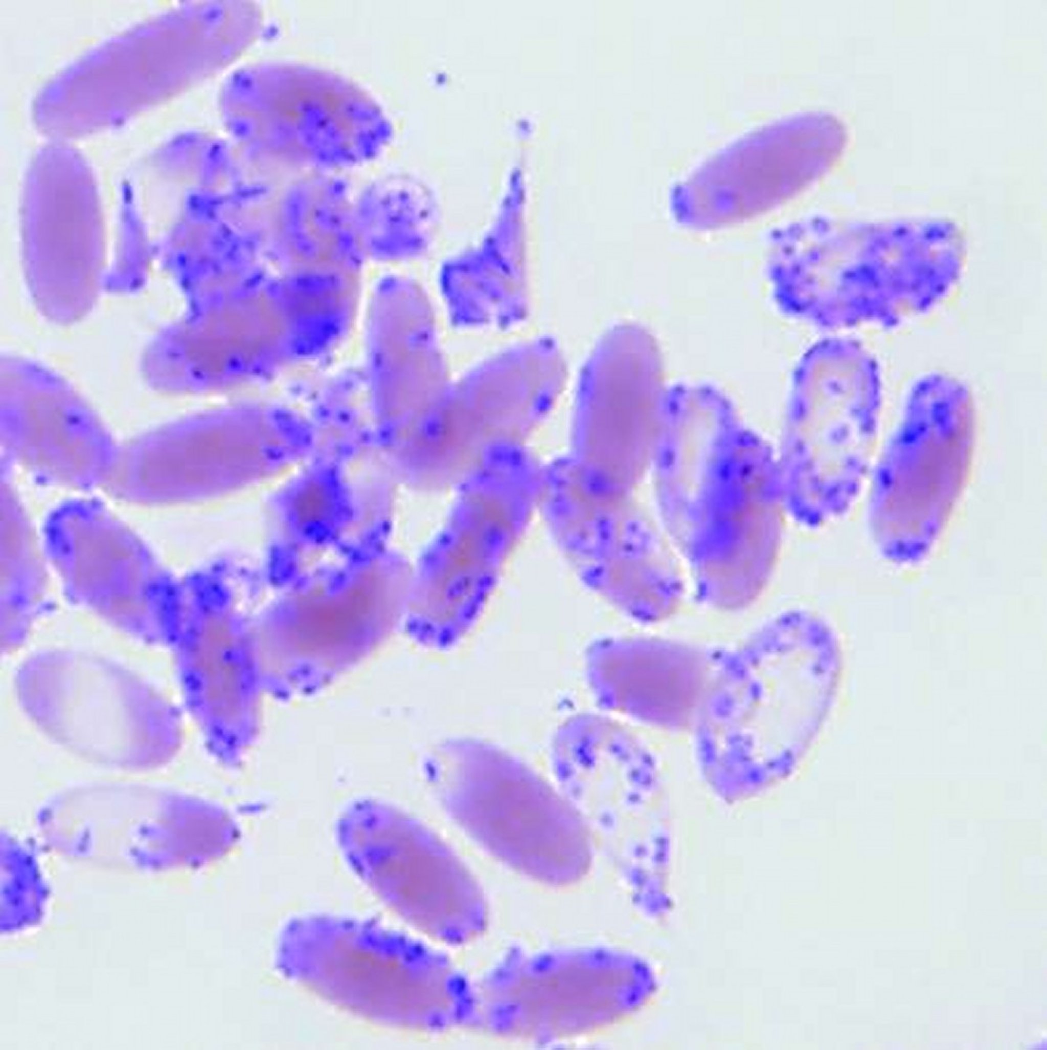 "<i >Candidatus Mycoplasma haemolamae</i>" infection, blood smear, cria