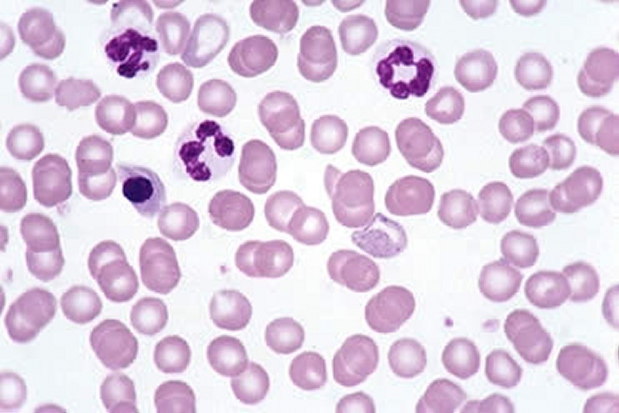 Canine blood smear, basophilic stippling, lead toxicity
