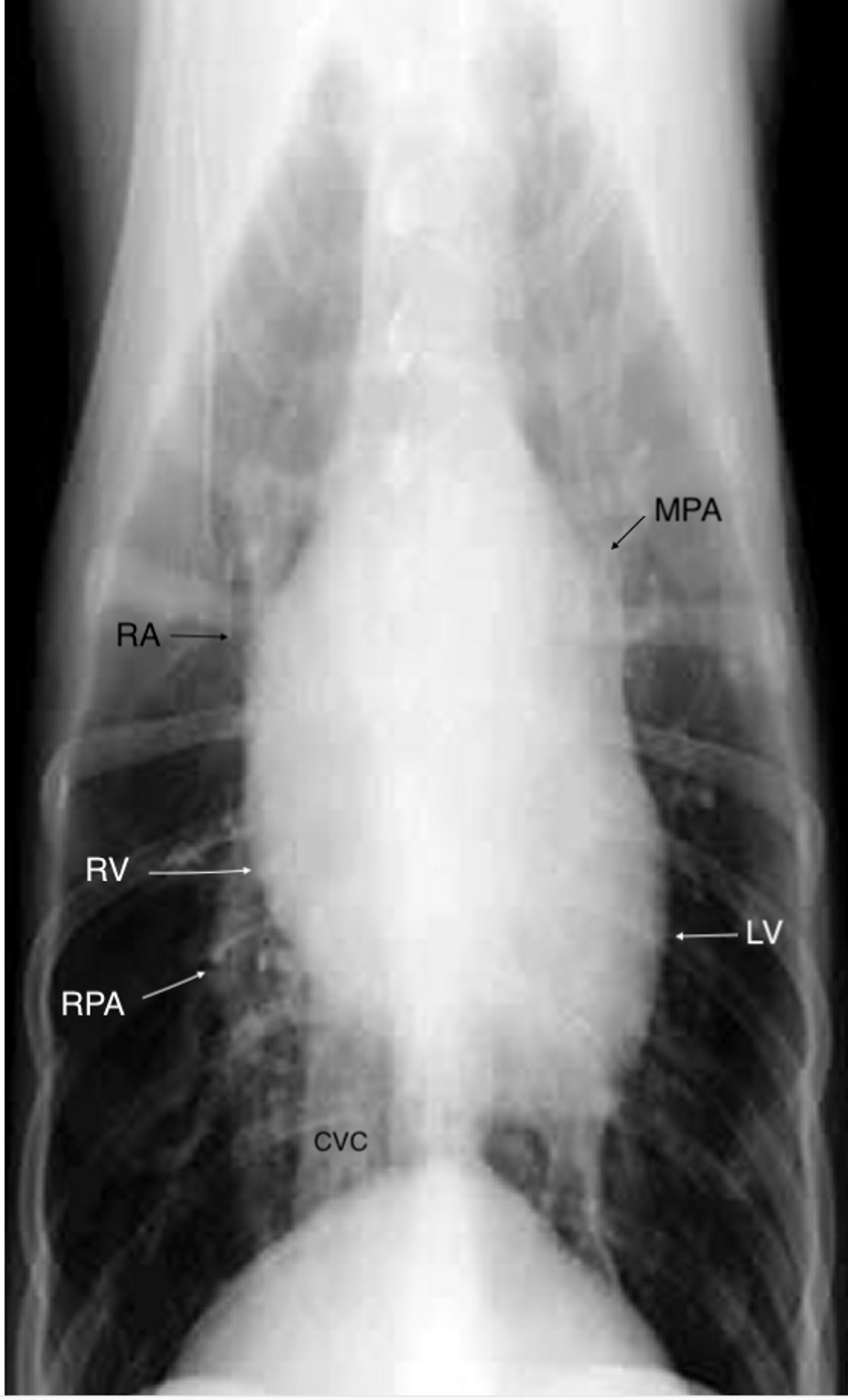 Canine heartworm disease, mild radiographic lesions (VD)