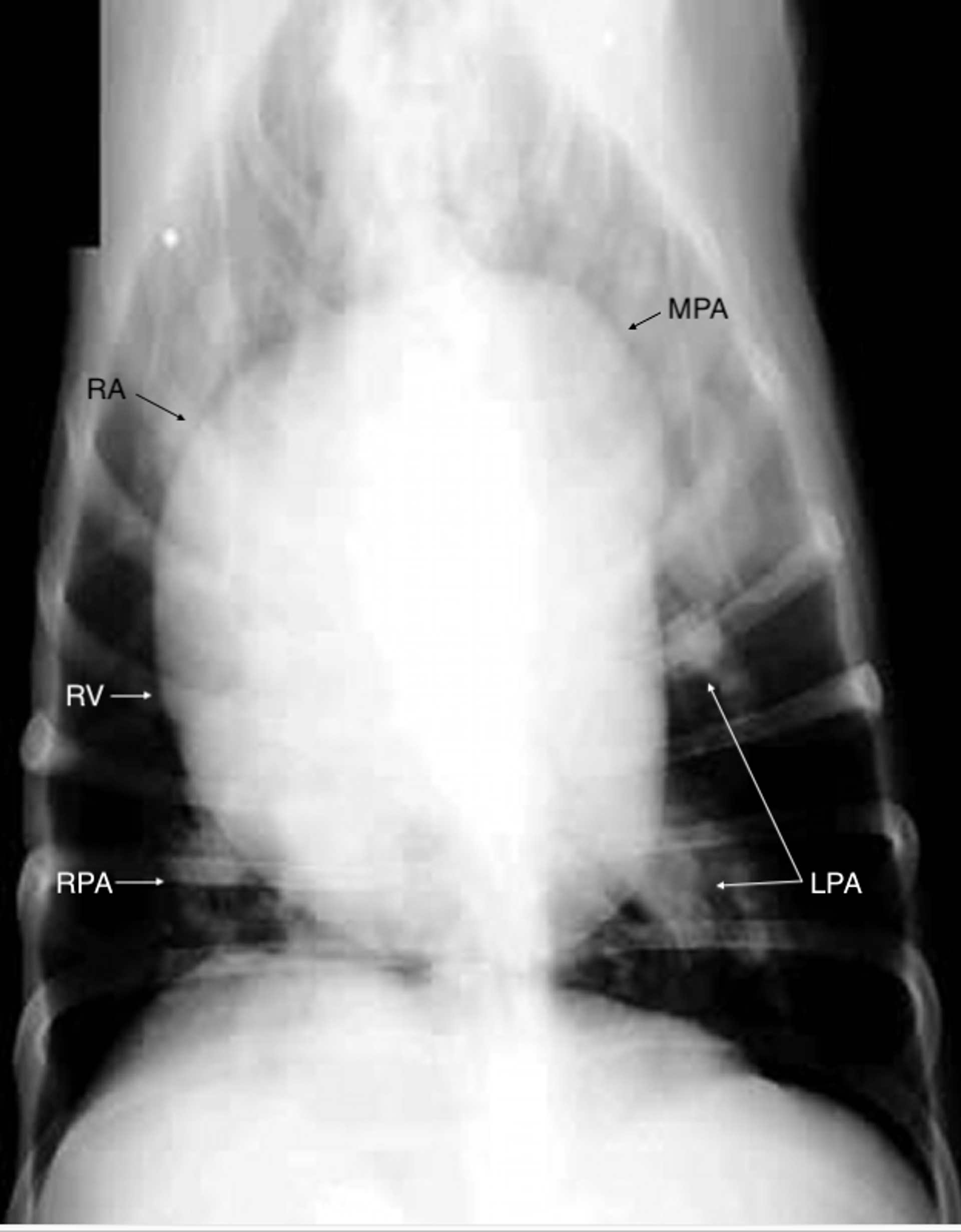 Enfermedad del gusano del corazón (dirofilariosis) canino, lesiones radiográficas graves (vista ventrodorsal)