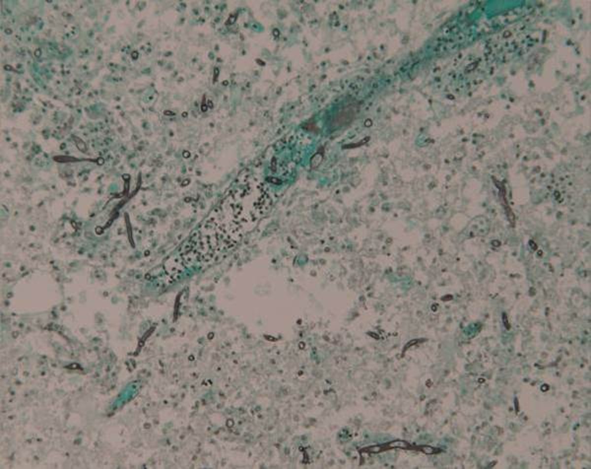 GMS-stained cerebellar histomicrograph