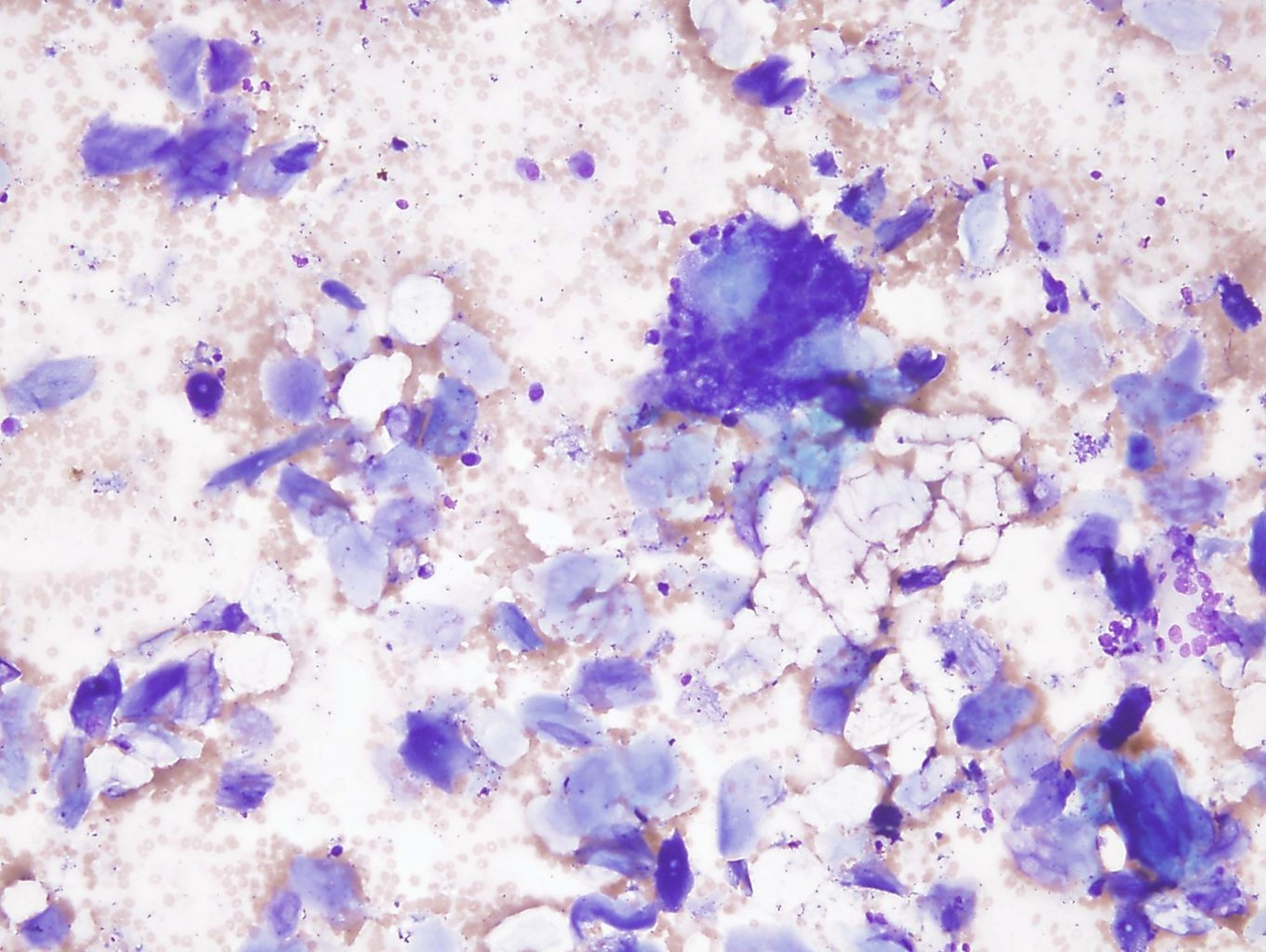 Cholesteatoma, cytology, dog