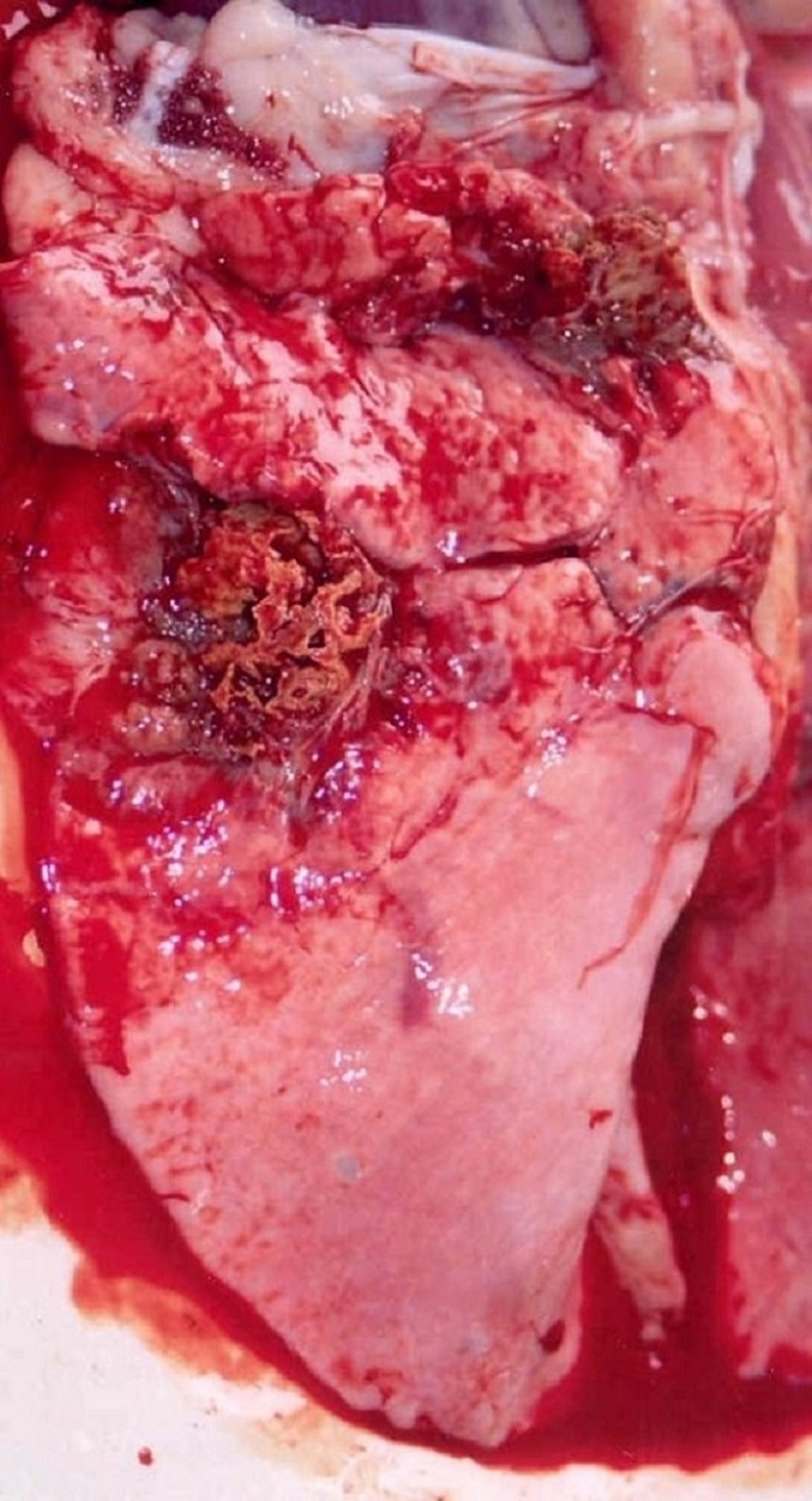 Chronic contagious caprine pleuropneumonia, lung