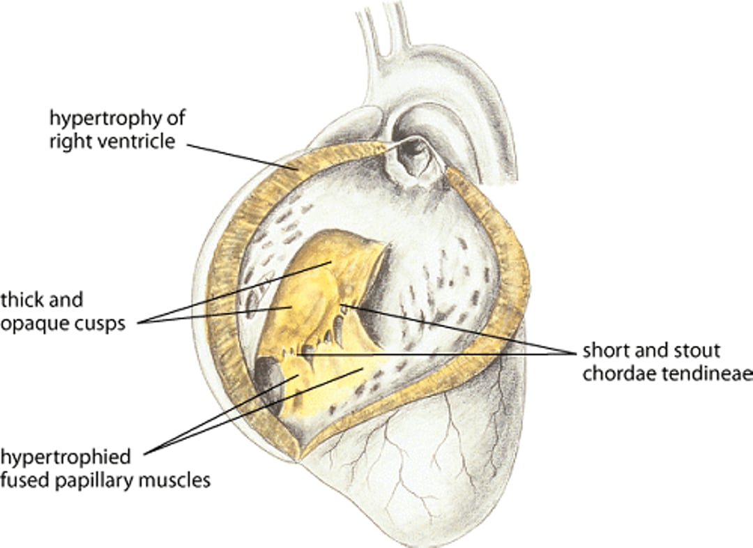 Tricuspid valve dysplasia, dog