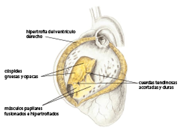 Displasia de la válvula tricúspide, perro