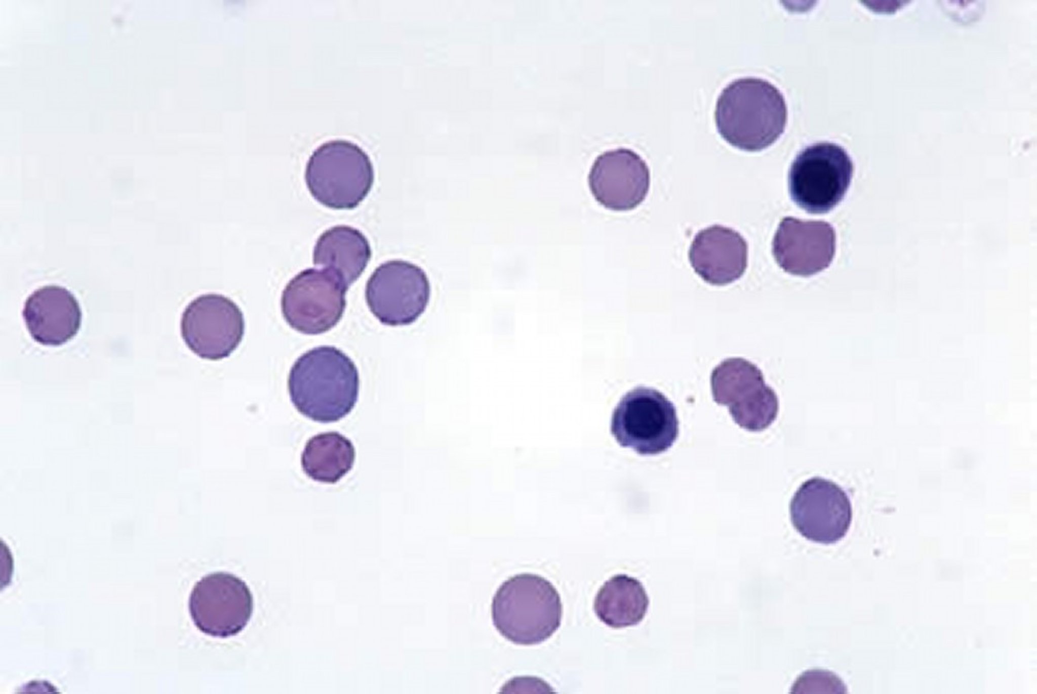 <i >Haemobartonella felis</i>, feline blood smear