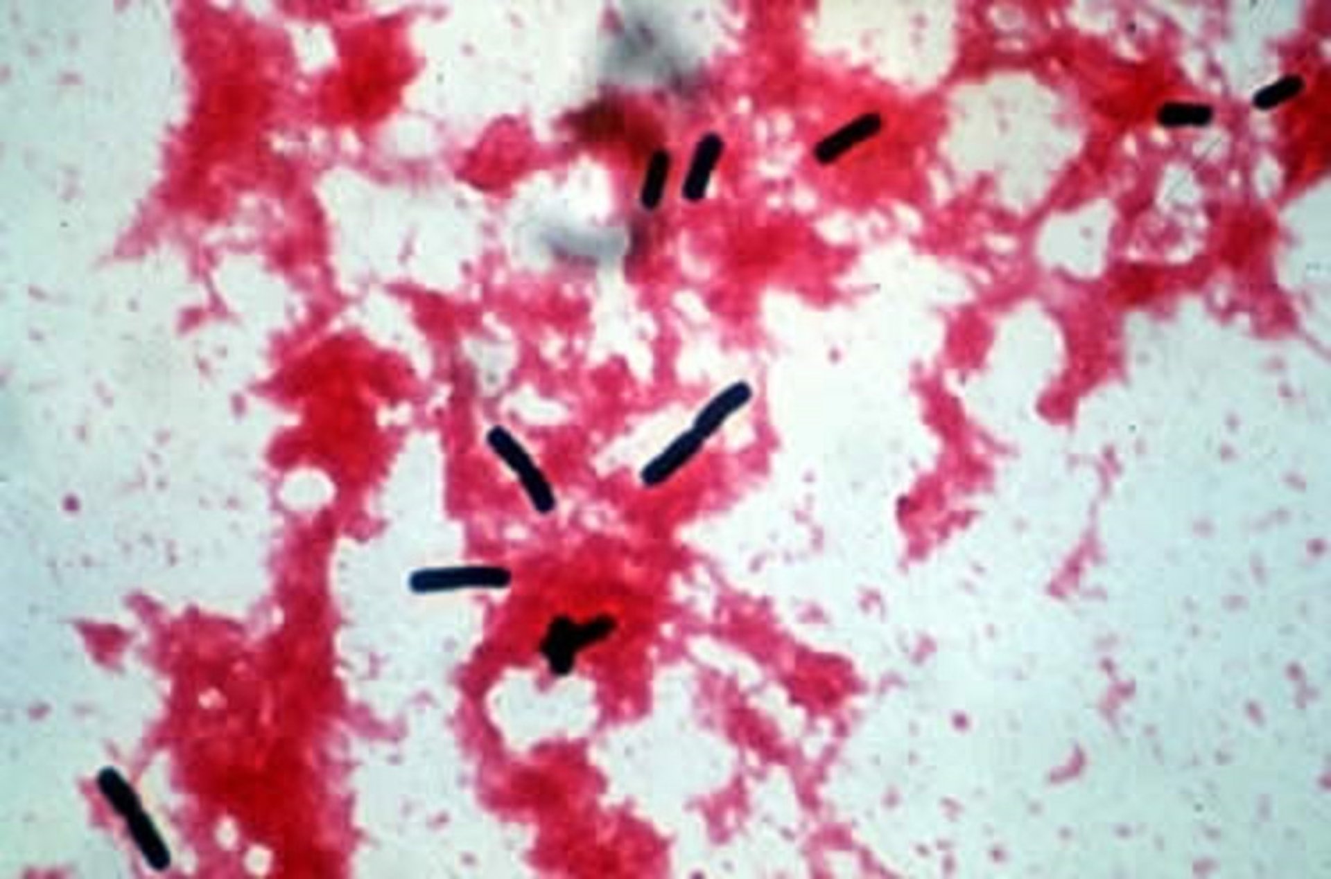 <i >Clostridium perfringens</i>, Gram-stained smear, pig