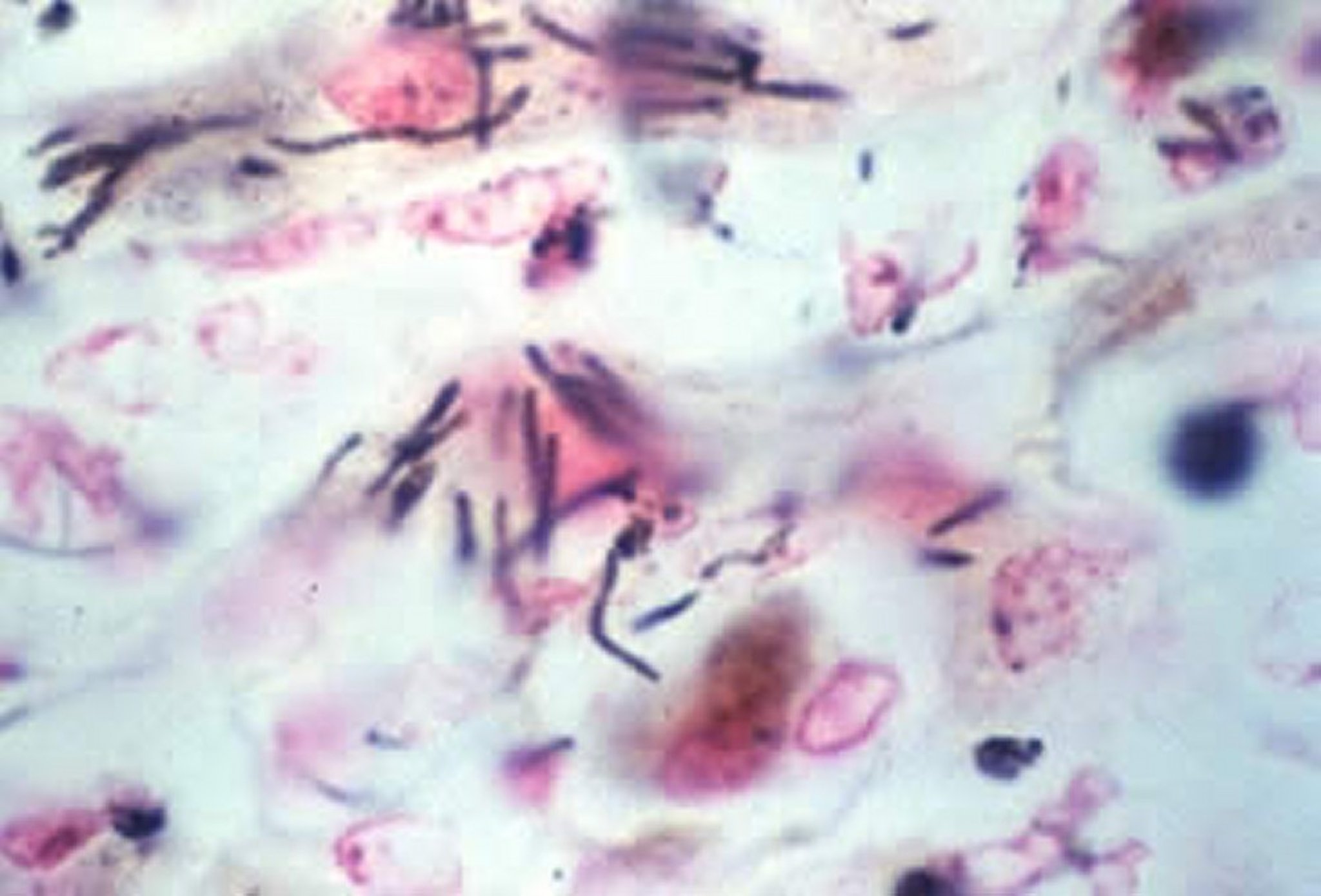 <i >Clostridium piliforme</i>, liver section, rabbit