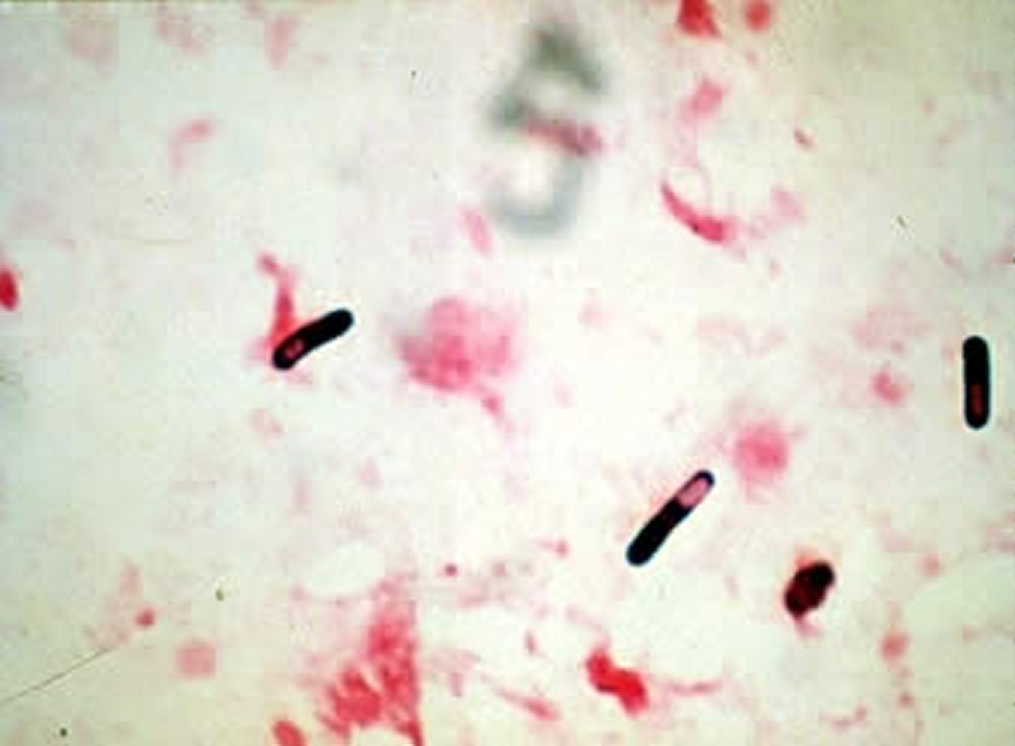 <i >Clostridium</i>spp, Gram stain