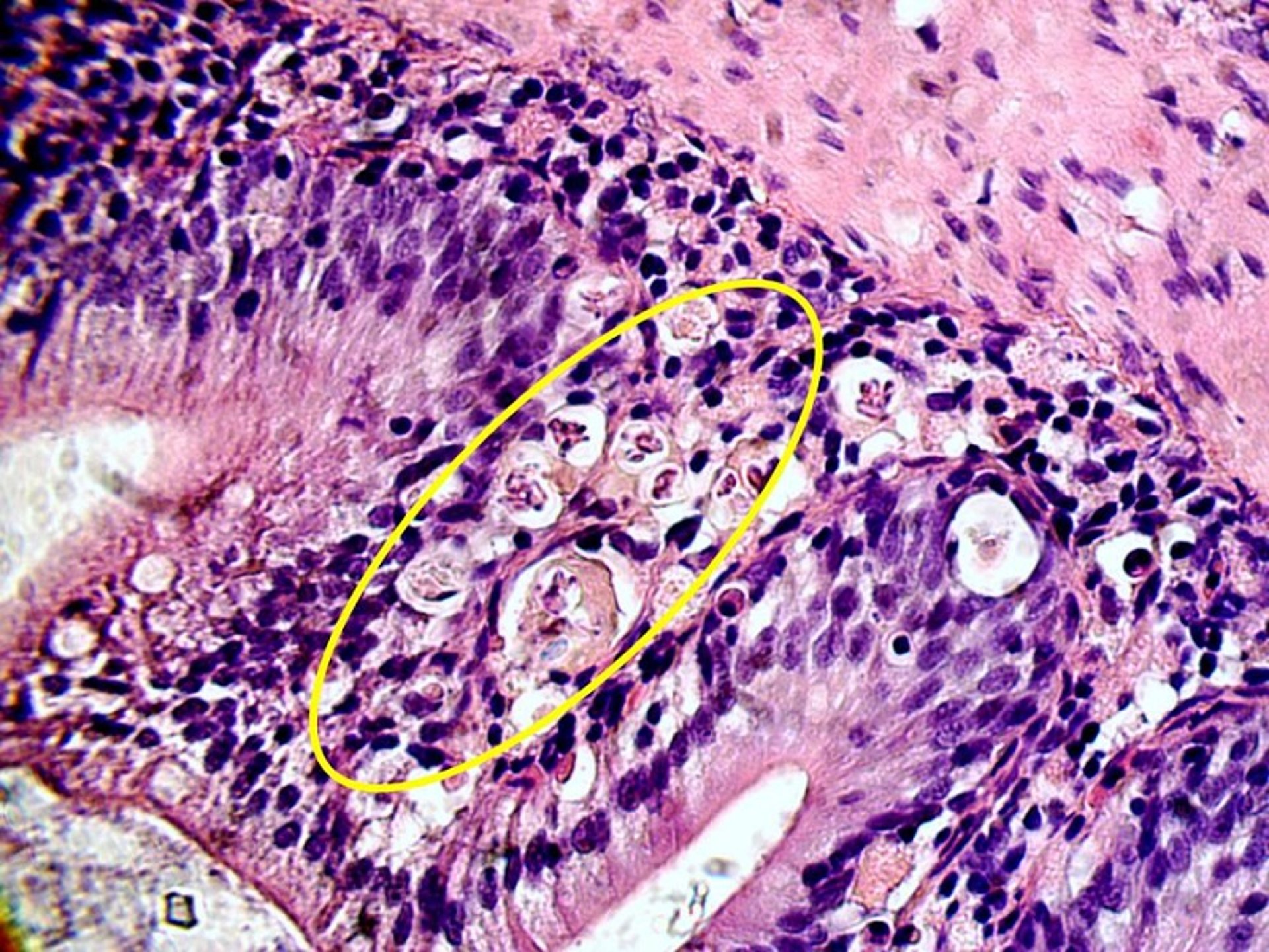 Coccidia, goldfish