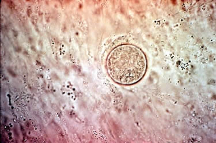 <i >Coccidioides immitis</i>, mature spherules