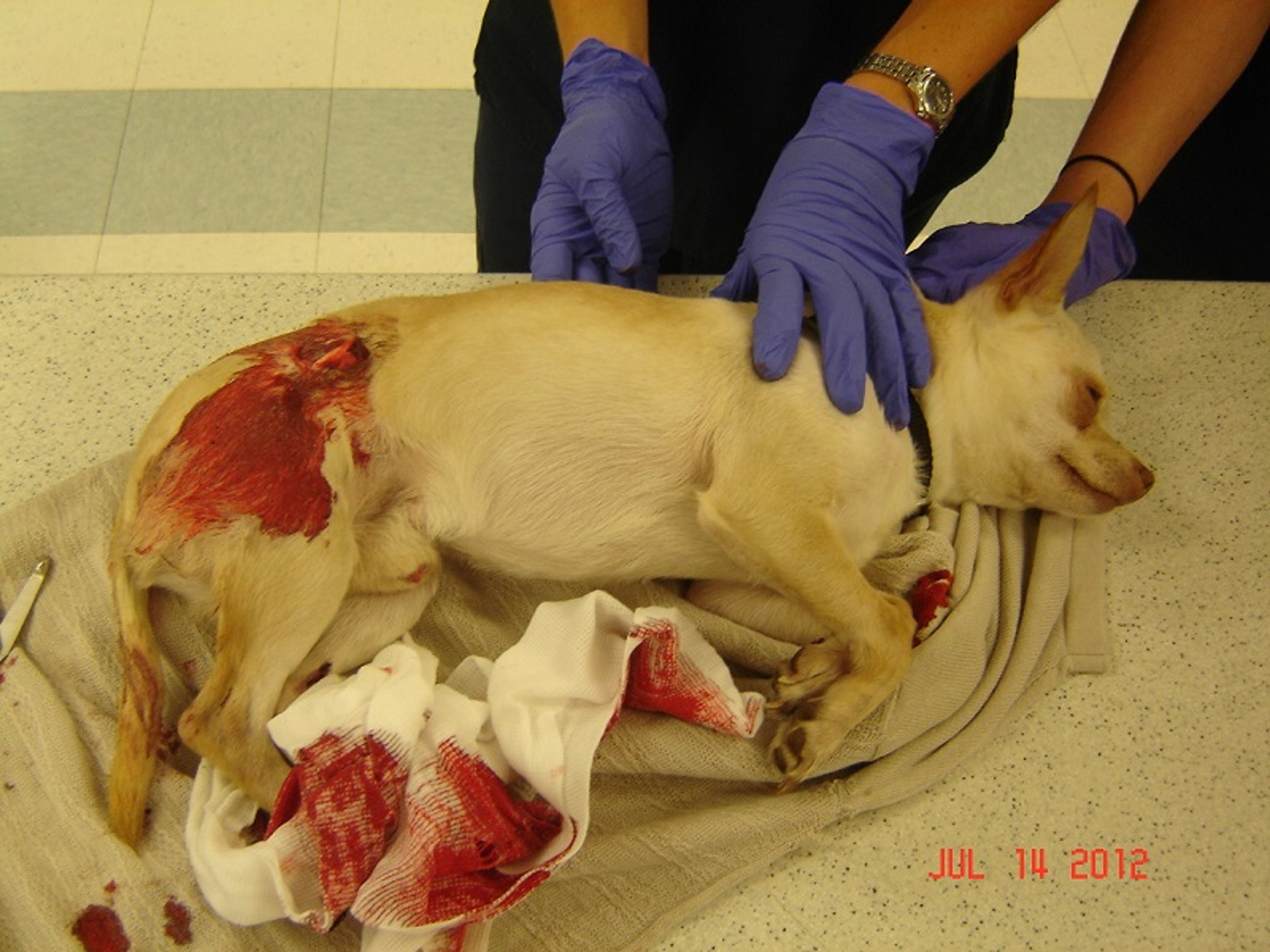 Trauma from collision with car