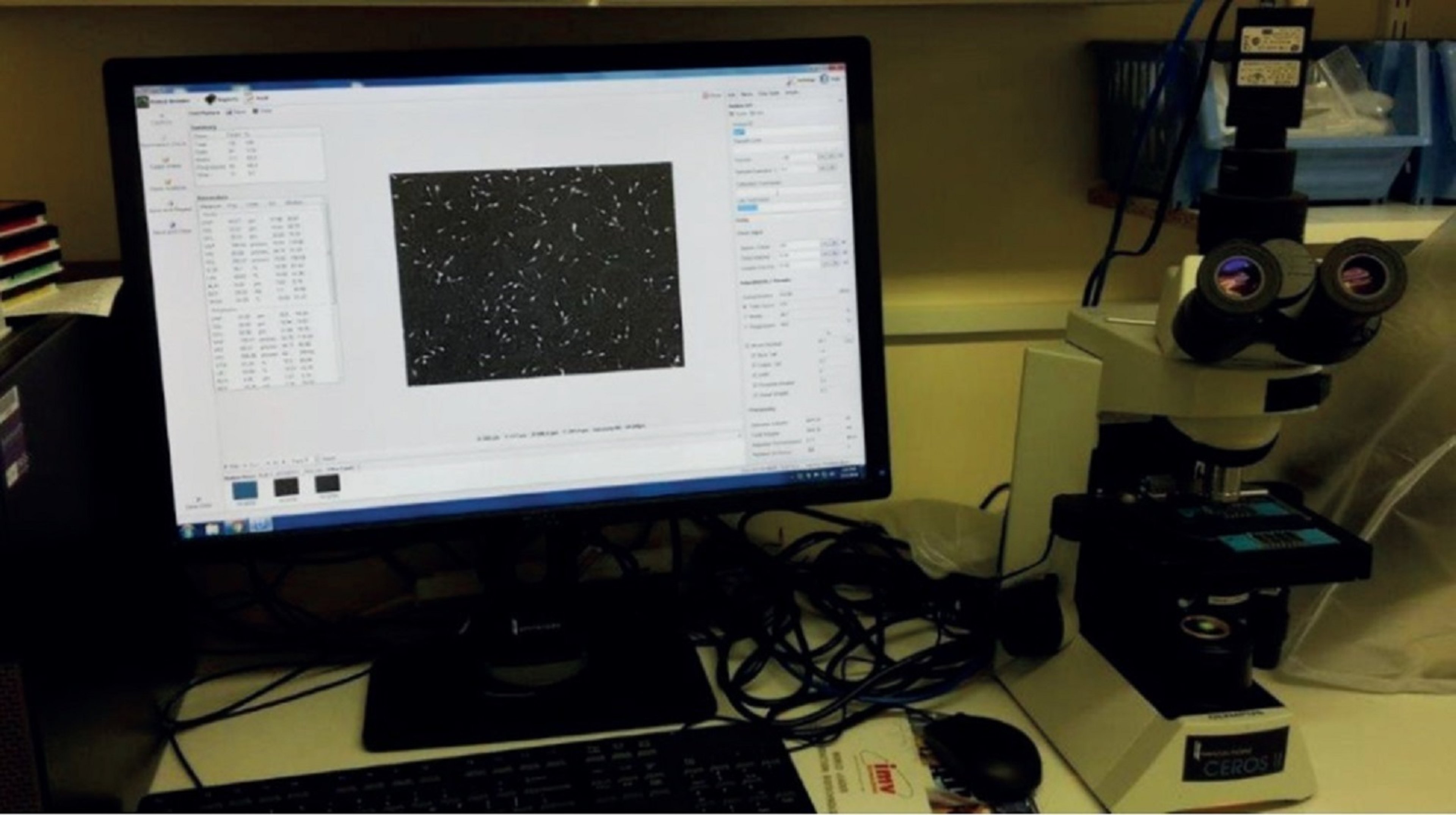 Computer-assisted semen analysis laboratory system