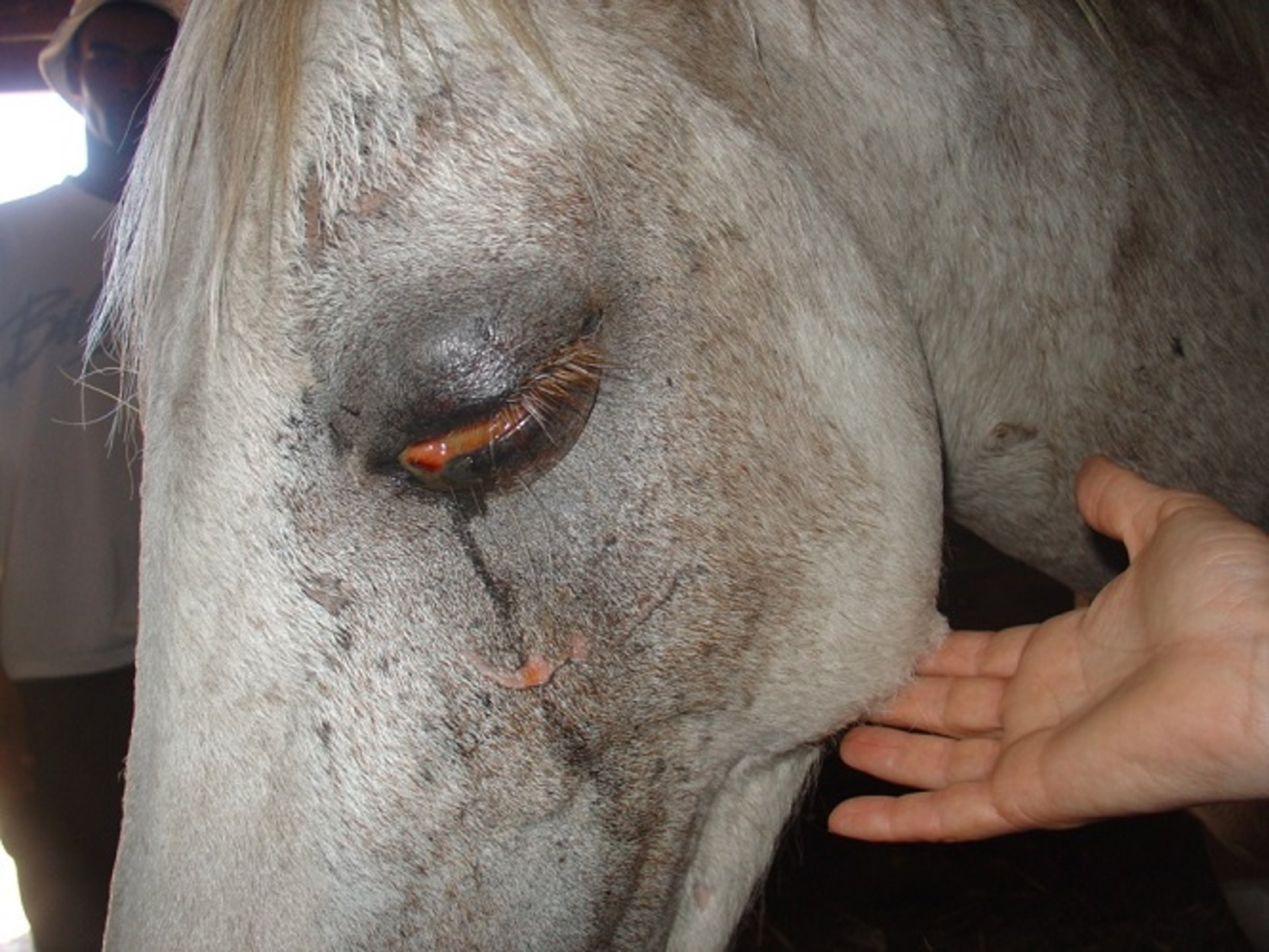 Conjunctival and periorbital swelling, AHS
