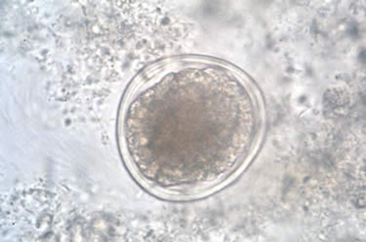 <i >Contracaecum</i> spp ovum