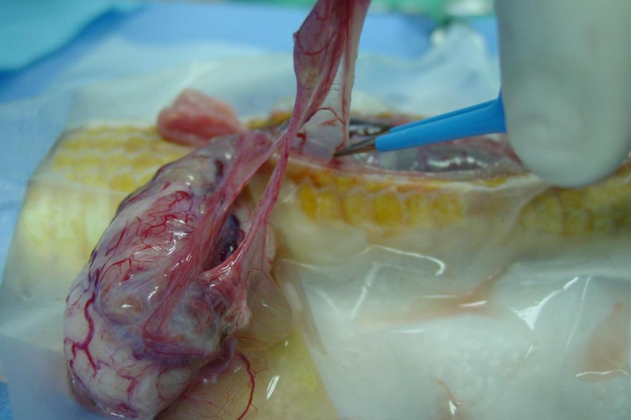 Surgical removal of ovarian granulosa cell tumor, corn snake