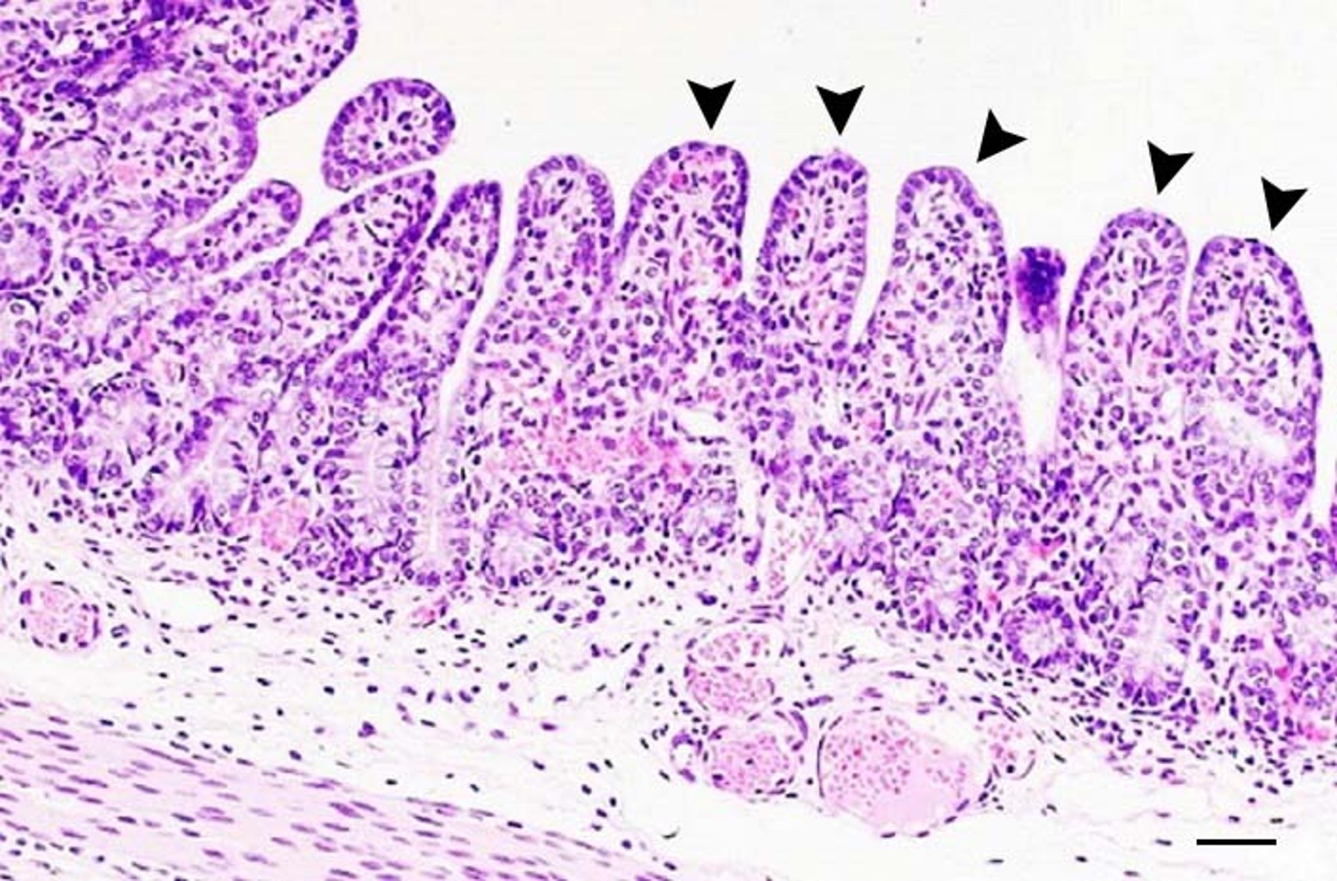 Coronaviral enteritis, histopathology, pig