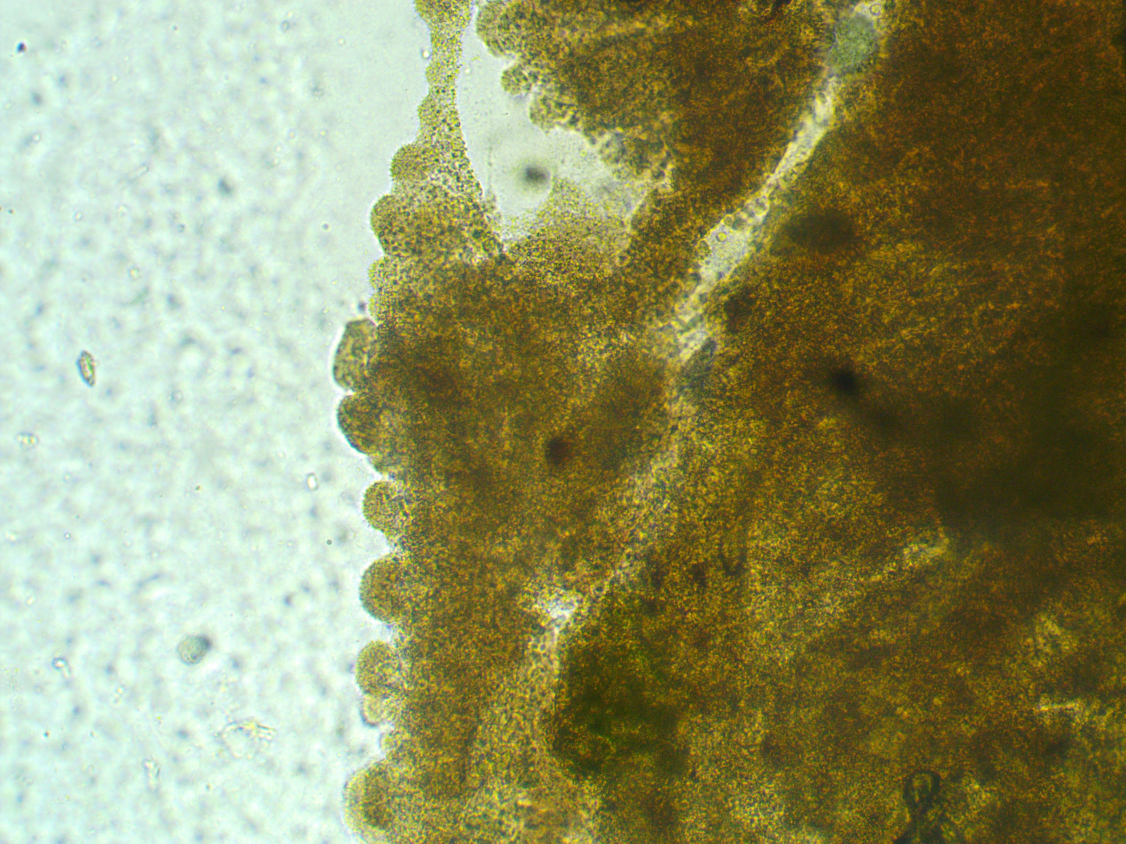 Wet mount of columnaris, skin of a <i >Corydoras</i> catfish