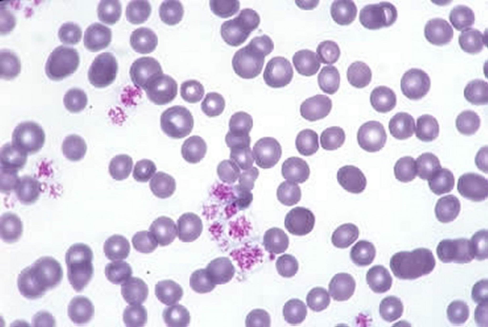 Nonregenerative anemia, blood smear, cat
