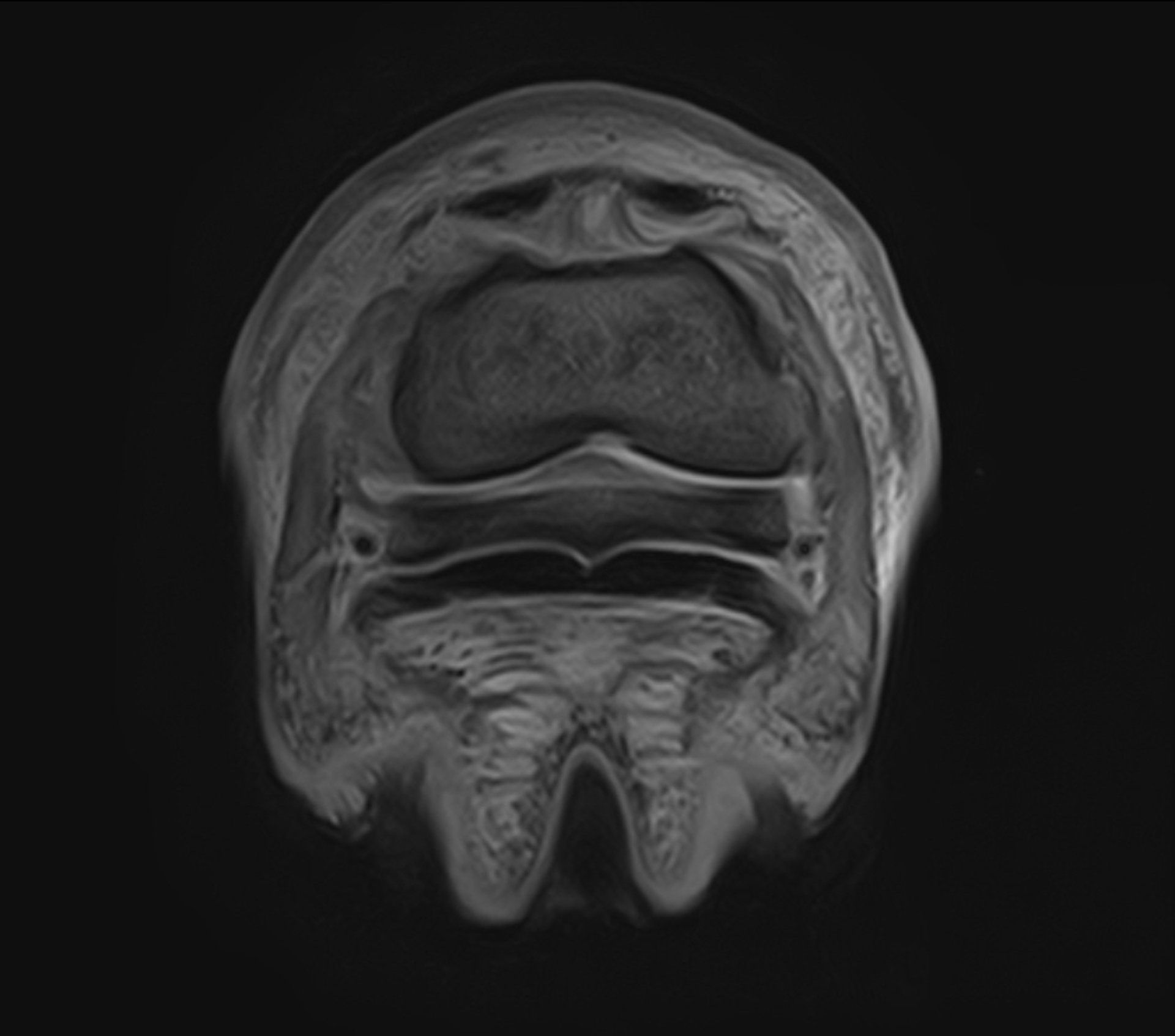 Leg, horse, cross-sectional MRI