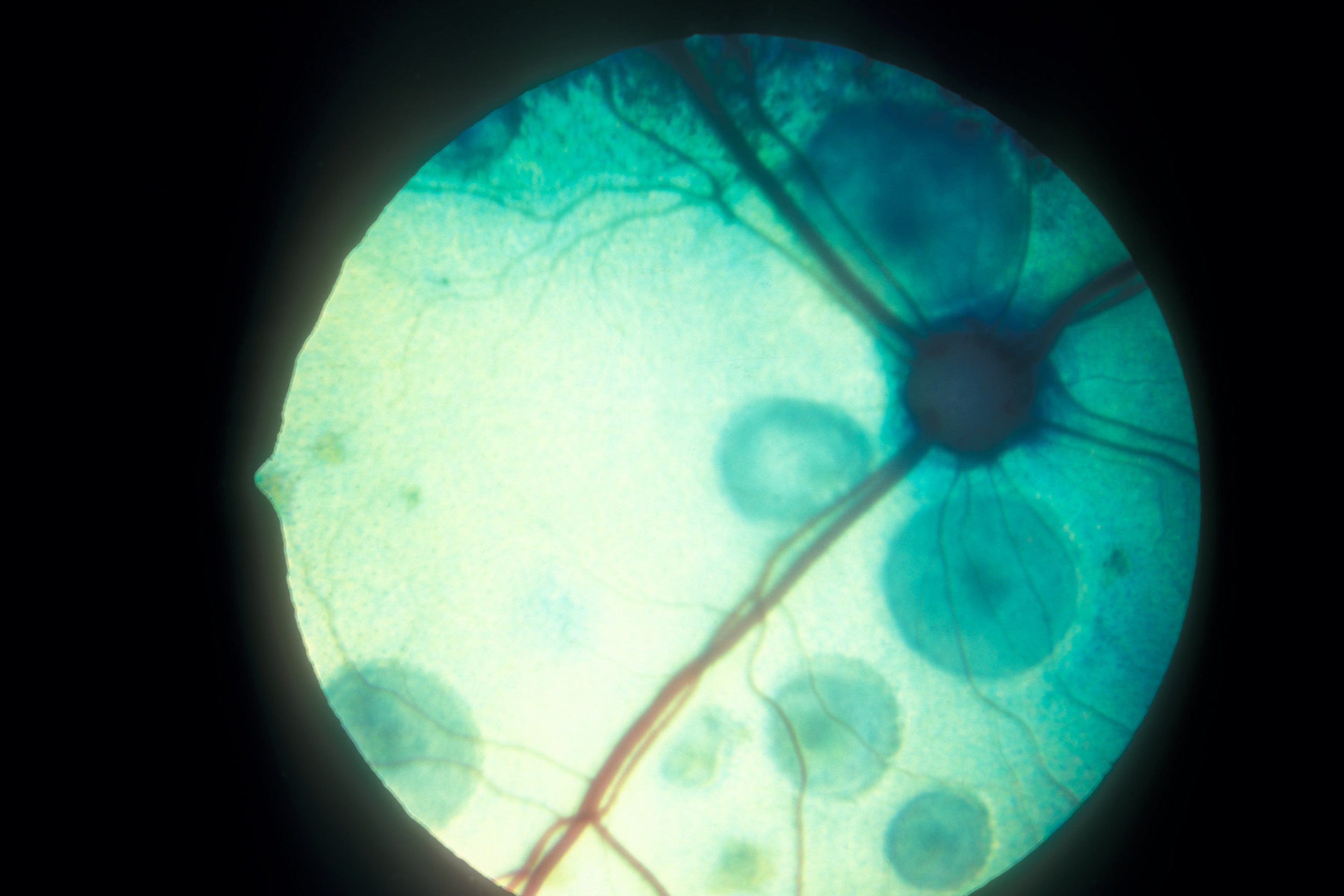 Cryptococcosis, cat