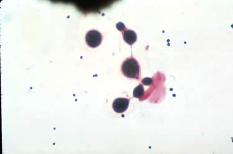 <i >Cryptococcus neoformans</i>, Gram stain
