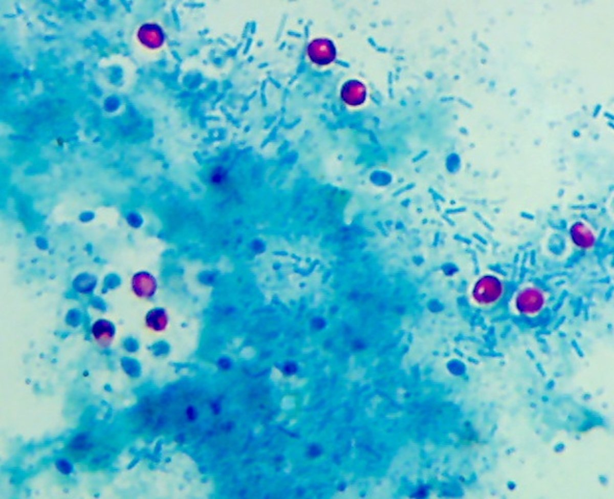 <i >Cryptosporidium parvum </i>oocysts, fecal smear