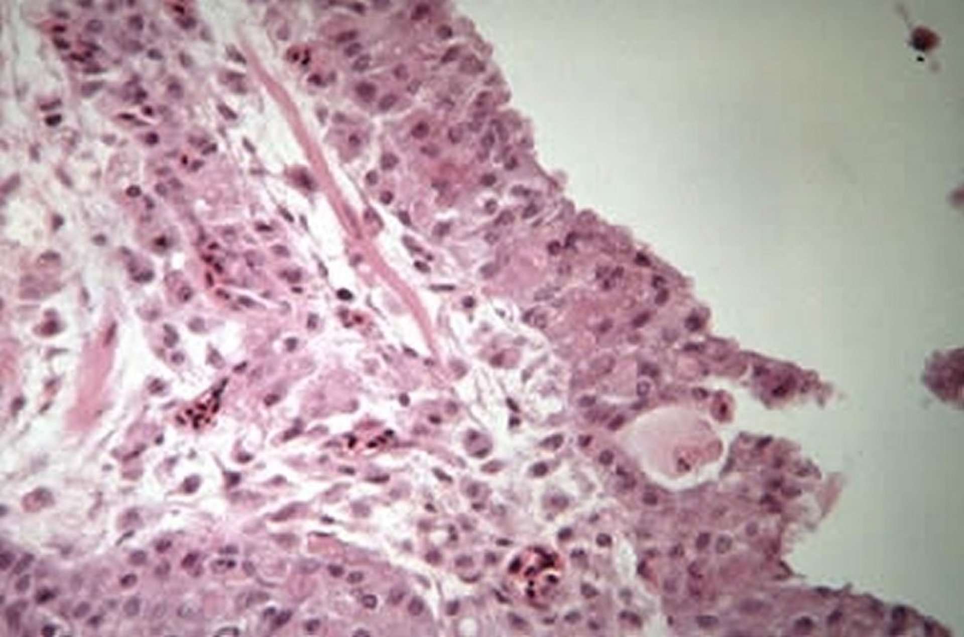 Cutaneous pox lesions, canary